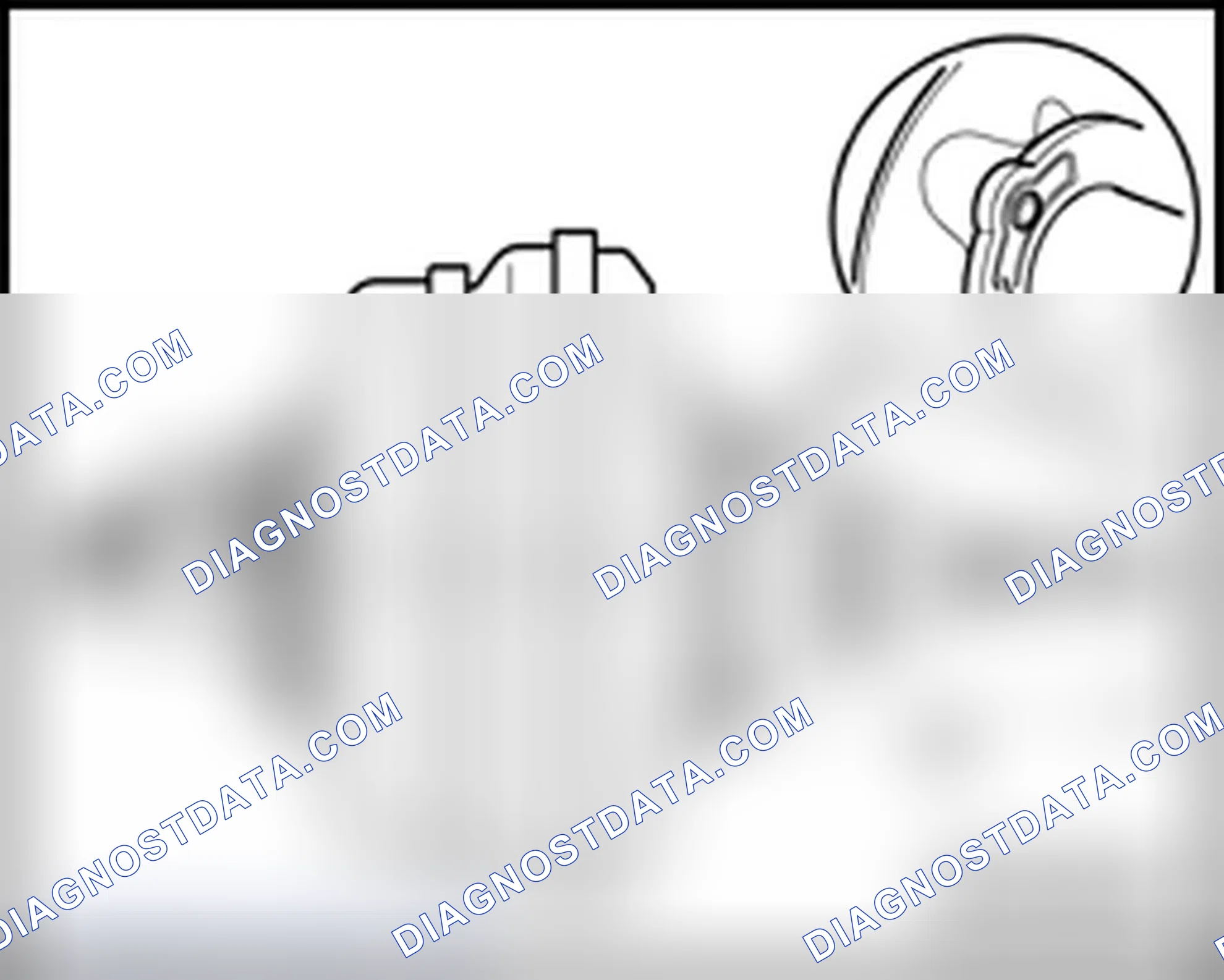 Scheme 149: Ball head, adjusting
