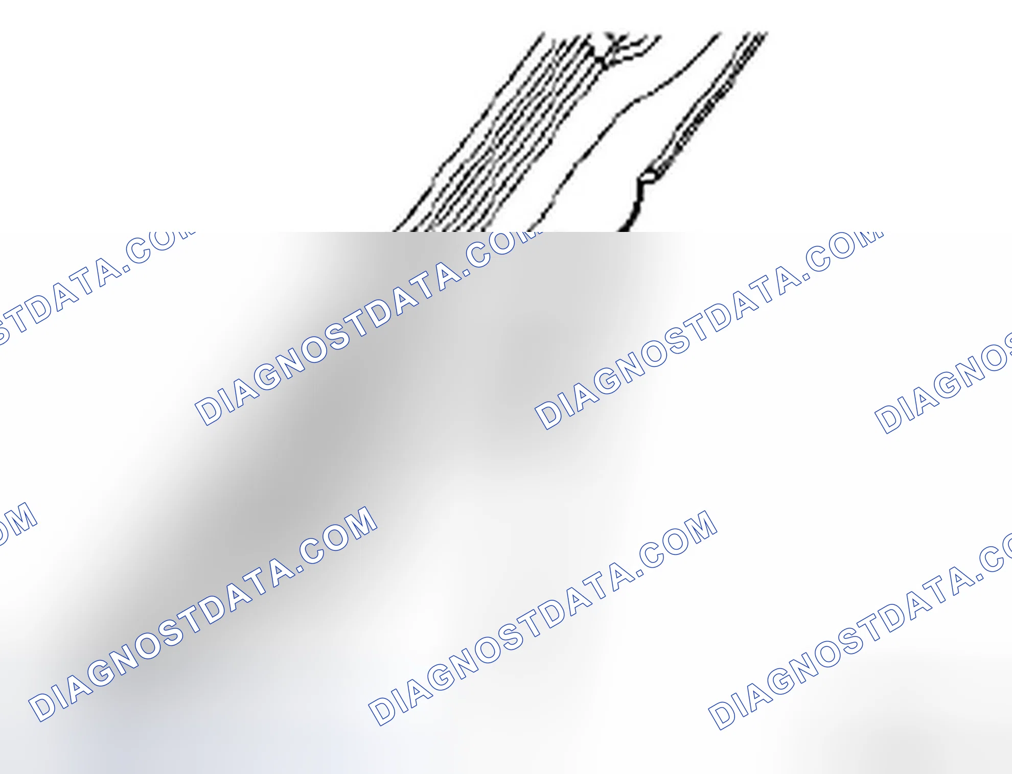 Scheme 8: Removal