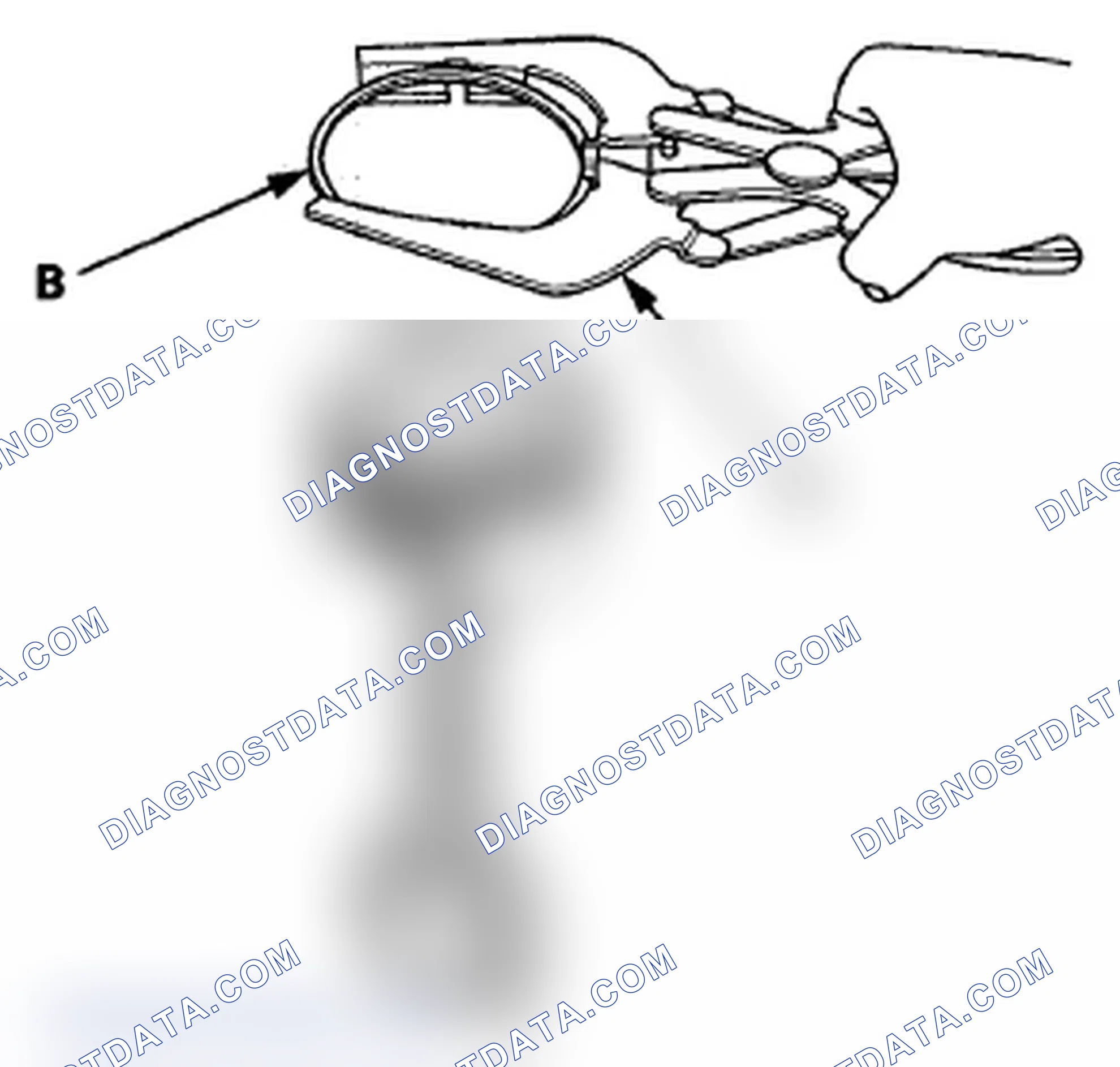 Scheme 383: Piston Ring Replacement