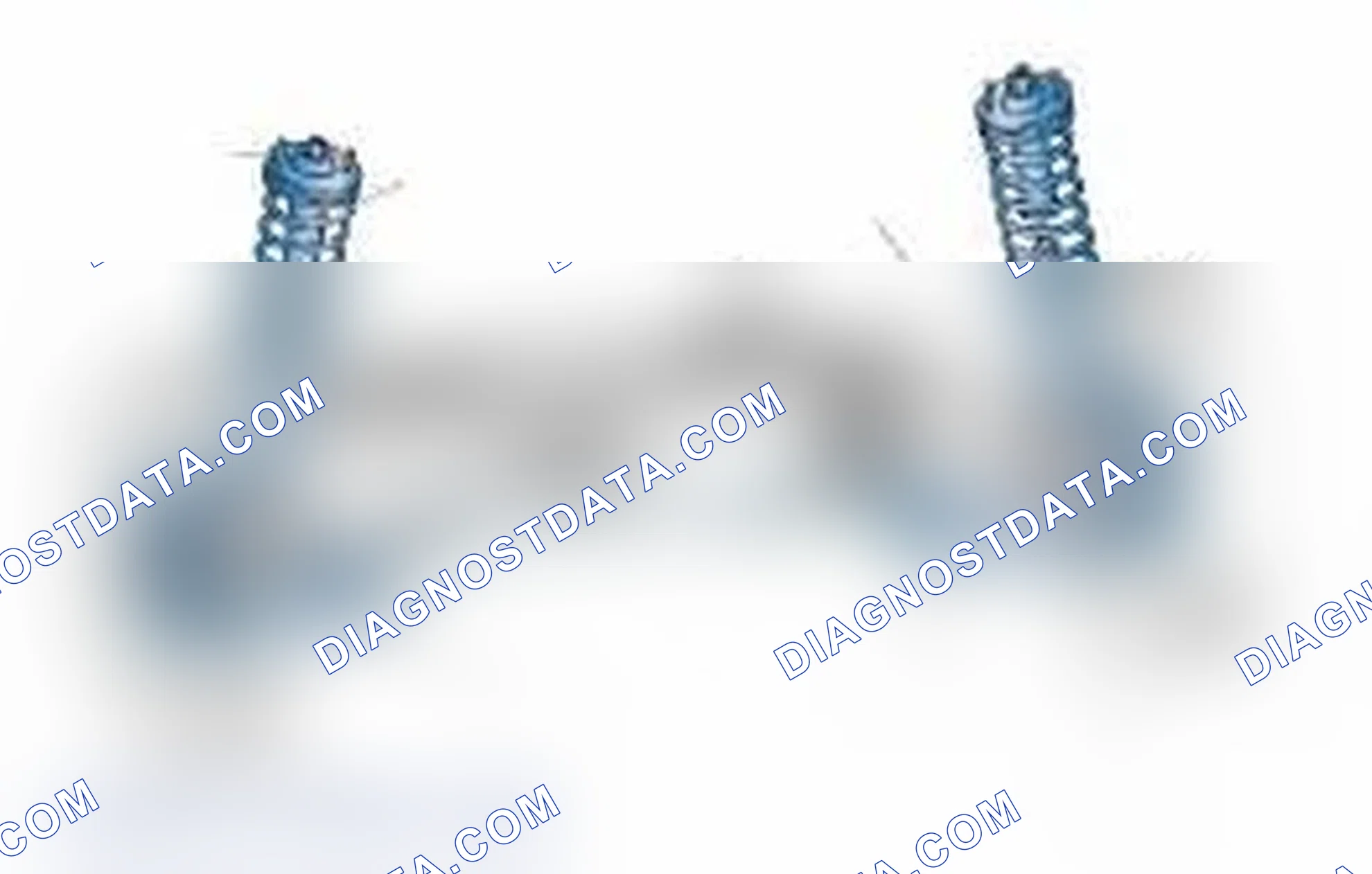 Scheme 25: Typical Front Suspension & Steering Components