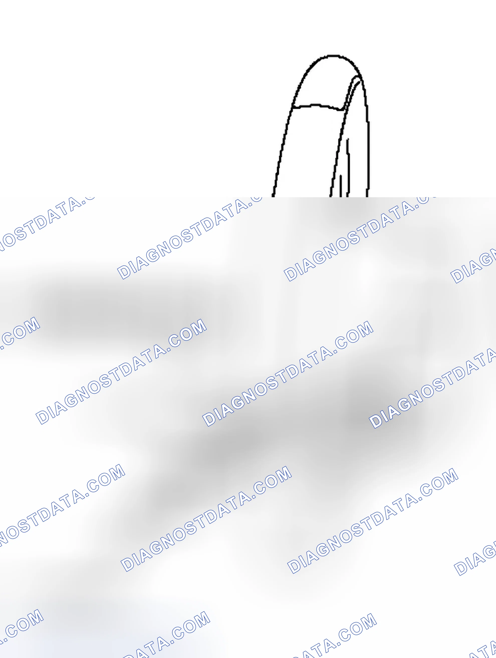 Scheme 32: << A >> STEERING WHEEL REMOVAL
