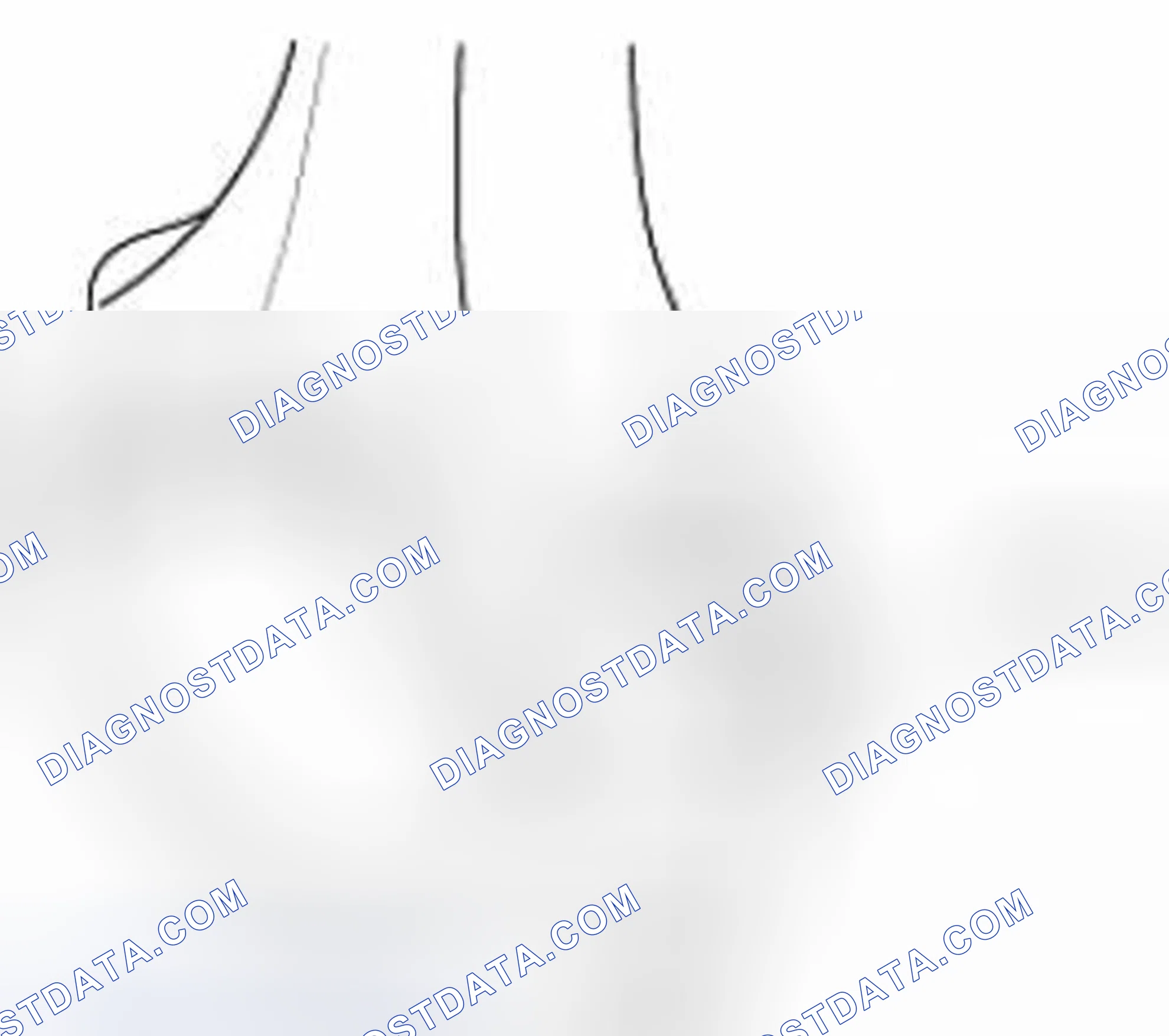 Scheme 189: Connecting rod mark location