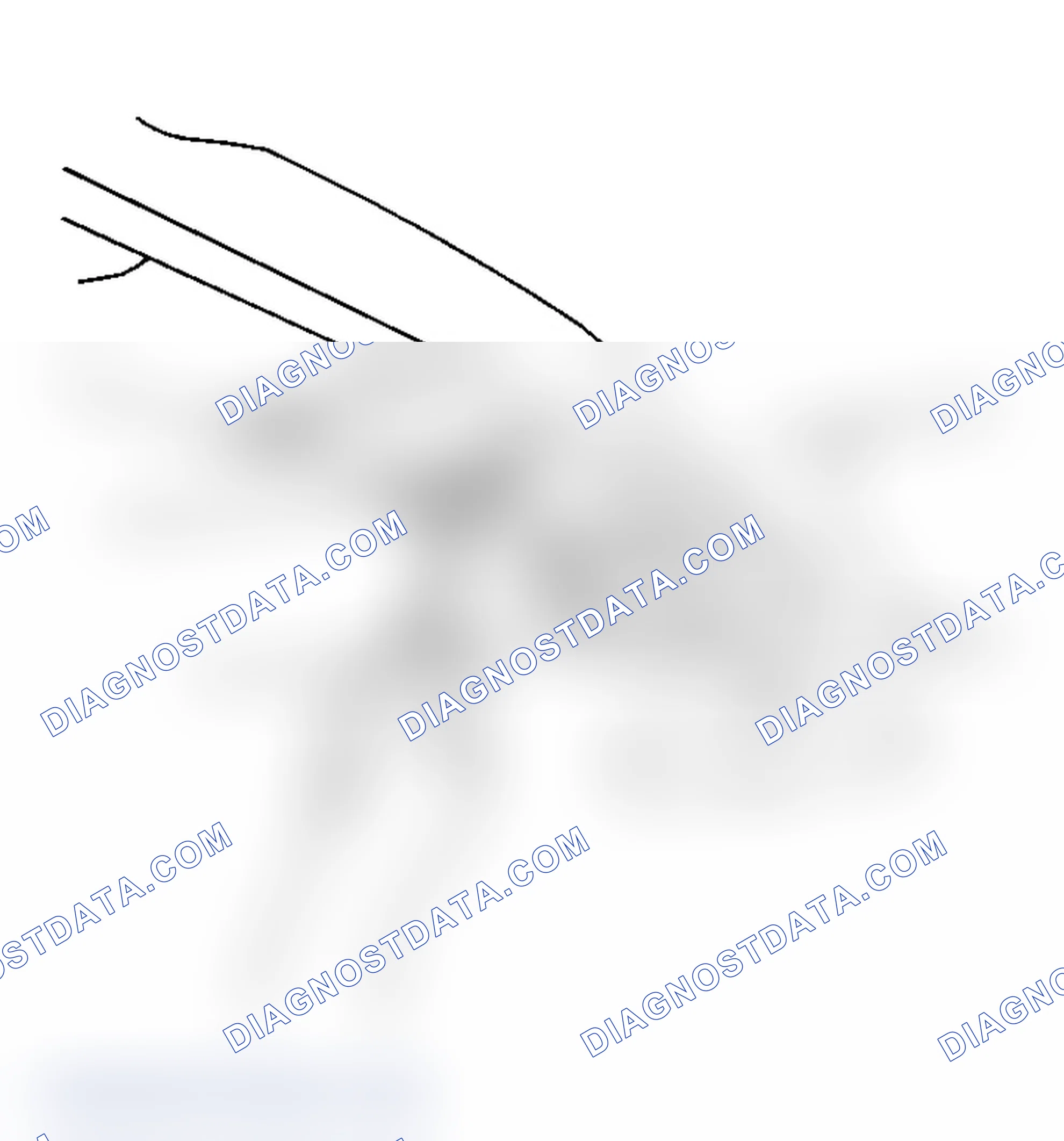 Scheme 3: Removal Procedure