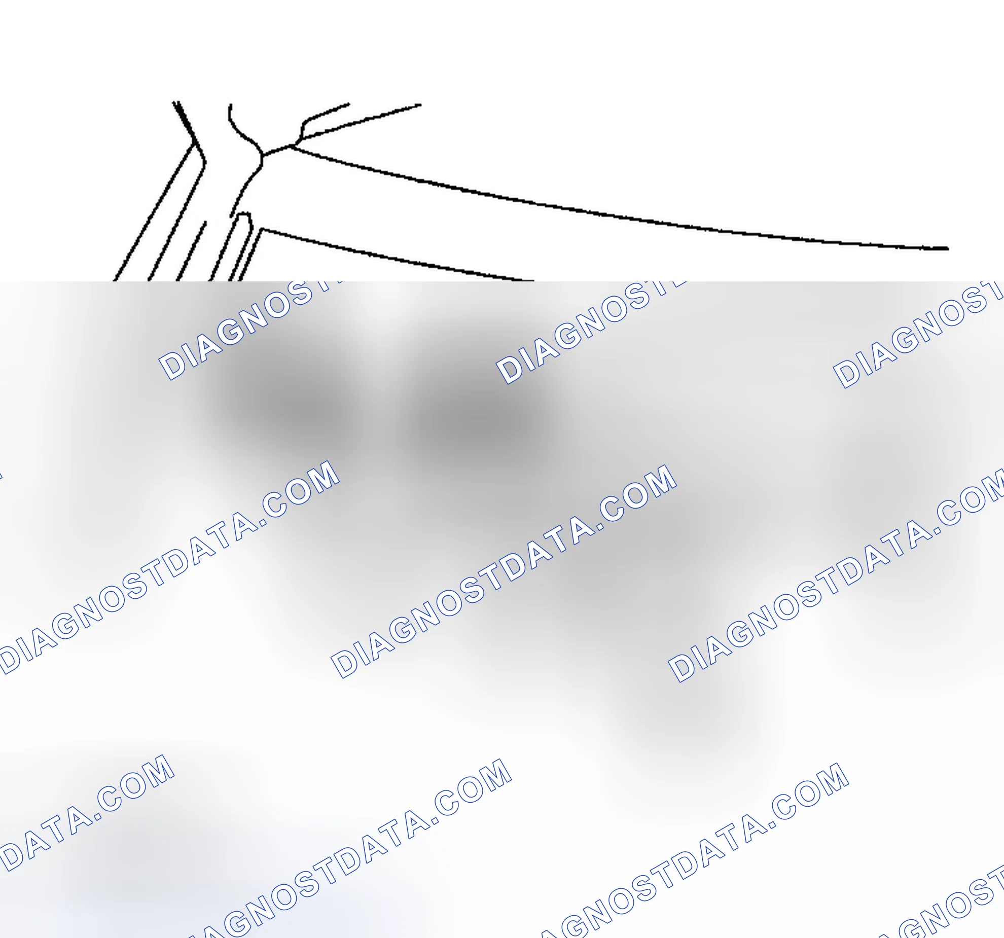 Scheme 89: REMOVAL