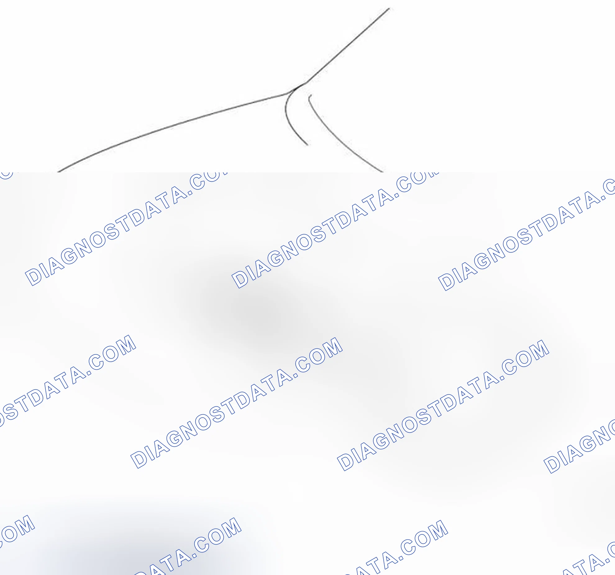 Scheme 37: Engine Mounting