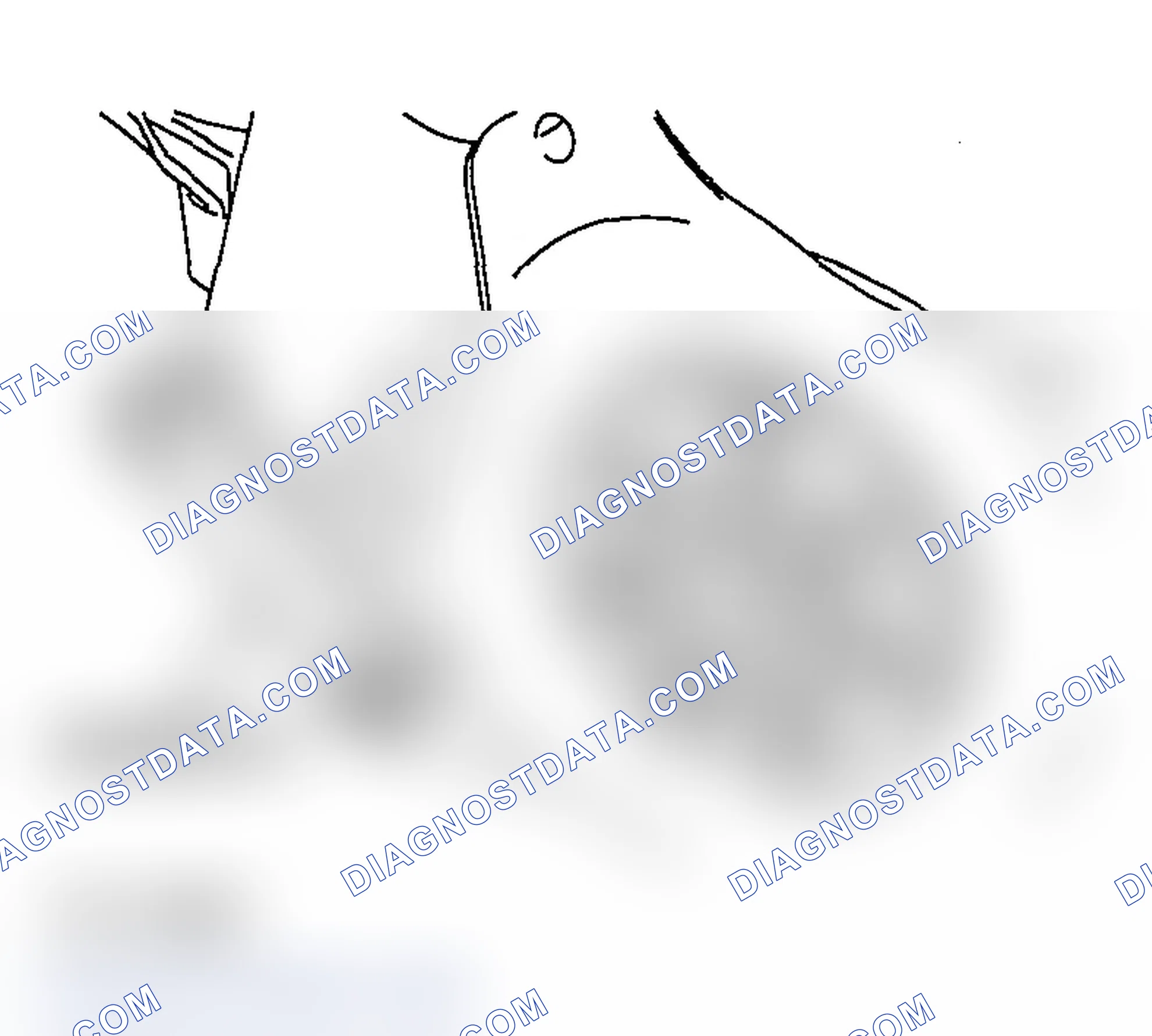 Scheme 585: << B>> CAMSHAFT POSITION SENSING CYLINDER REMOVAL