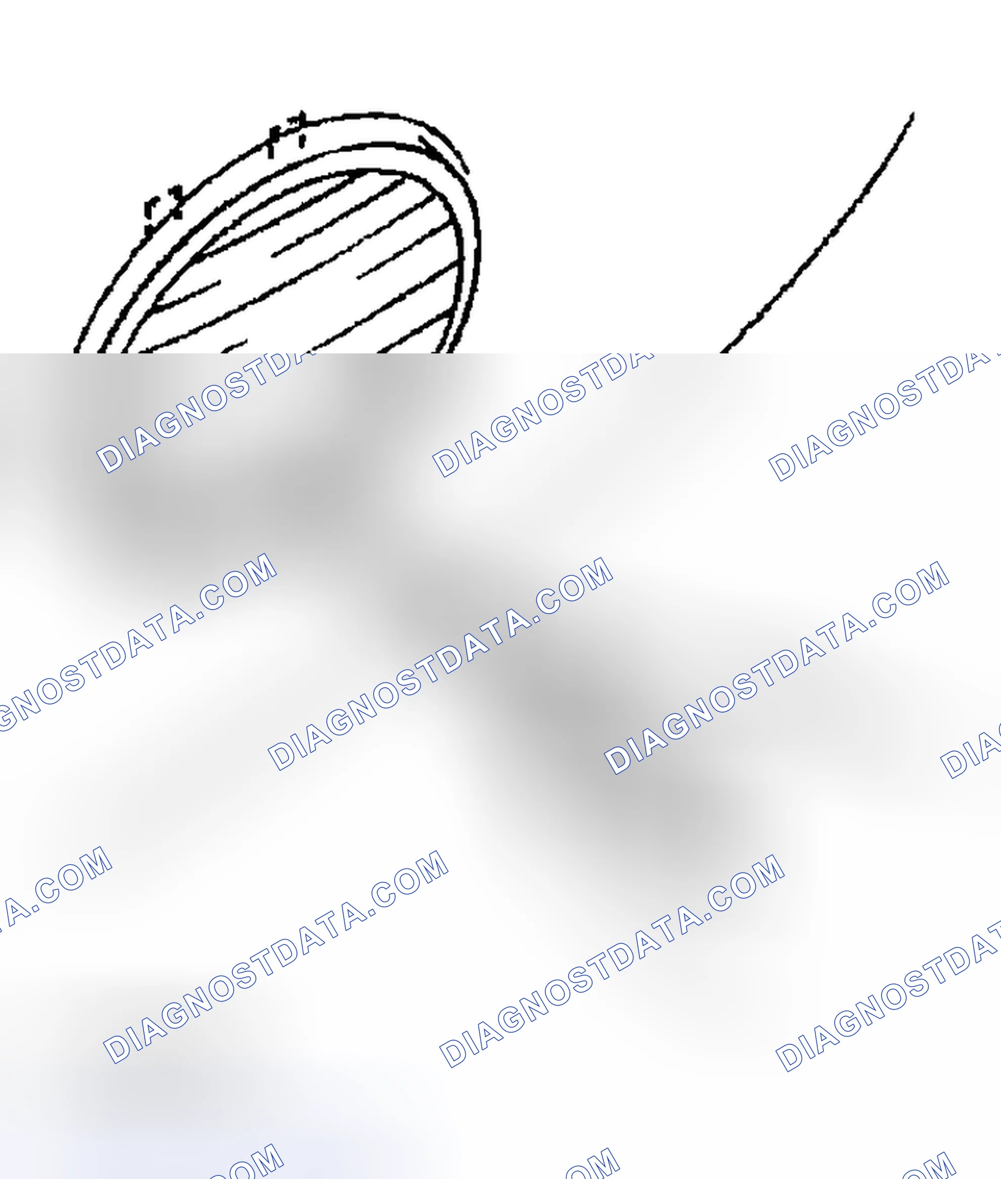 Scheme 72: LENS REMOVAL NOTE