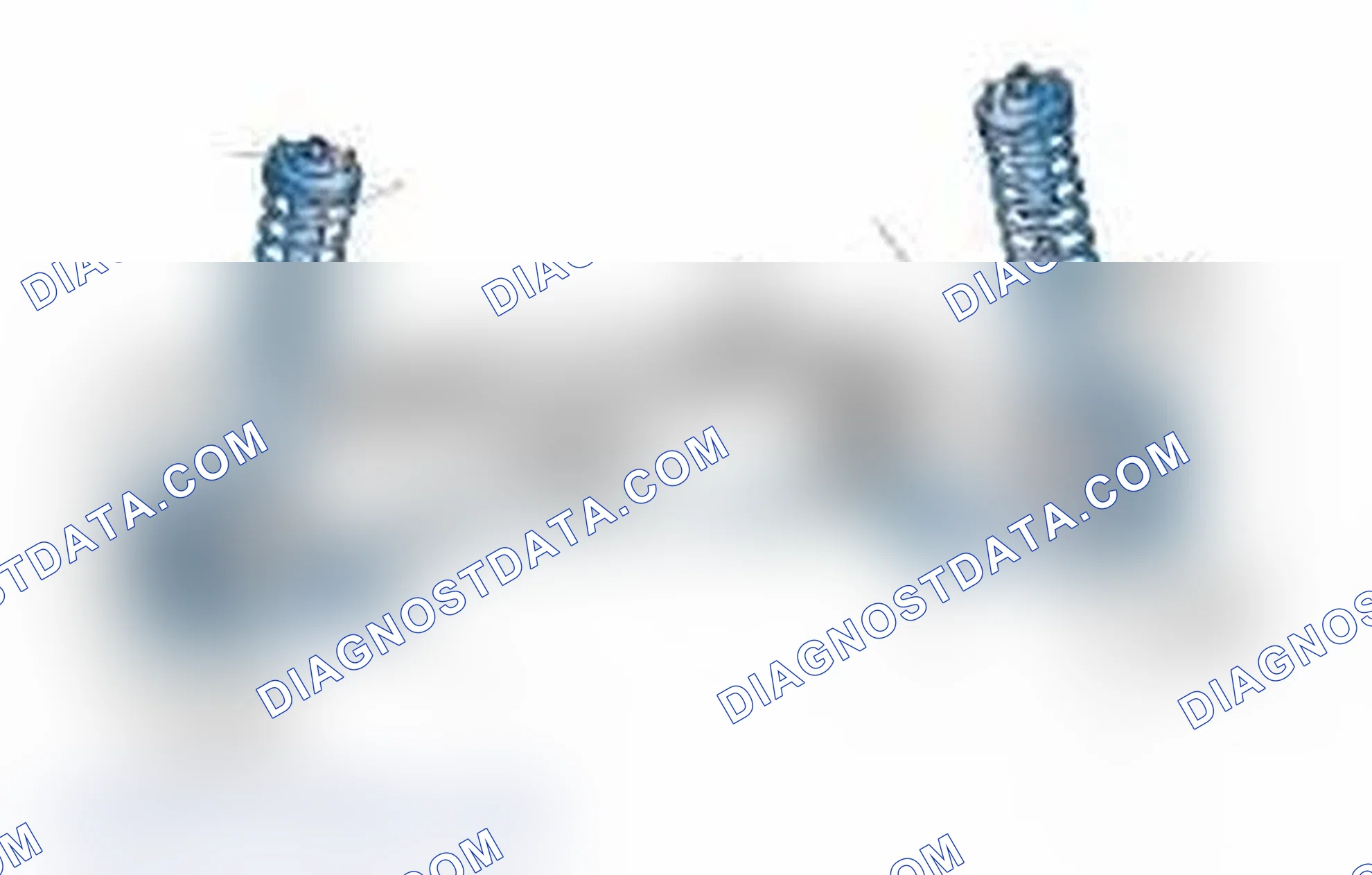 Scheme 25: Typical Front Suspension & Steering Components