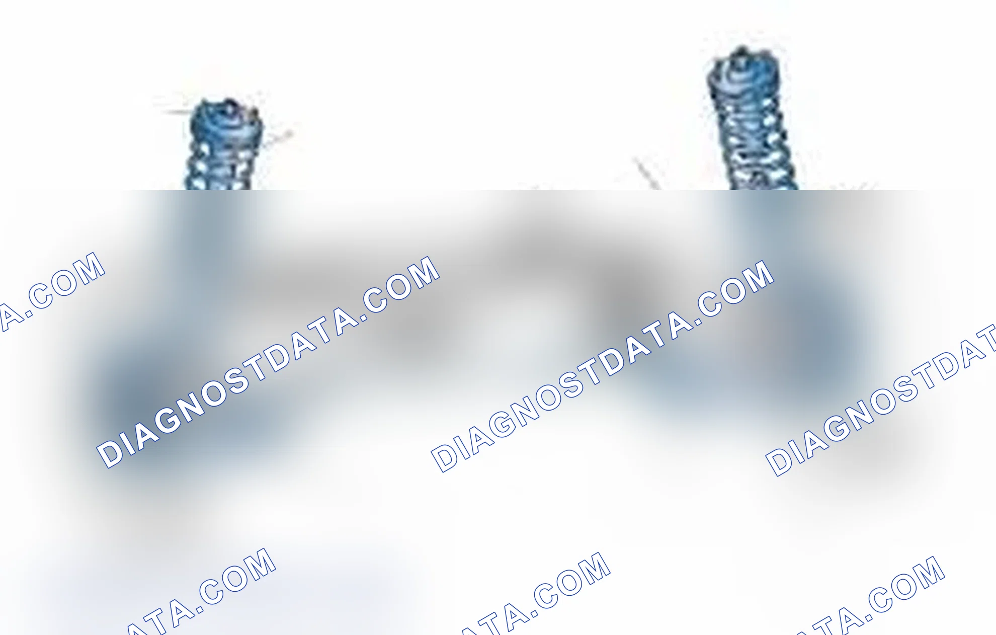 Scheme 25: Typical Front Suspension & Steering Components