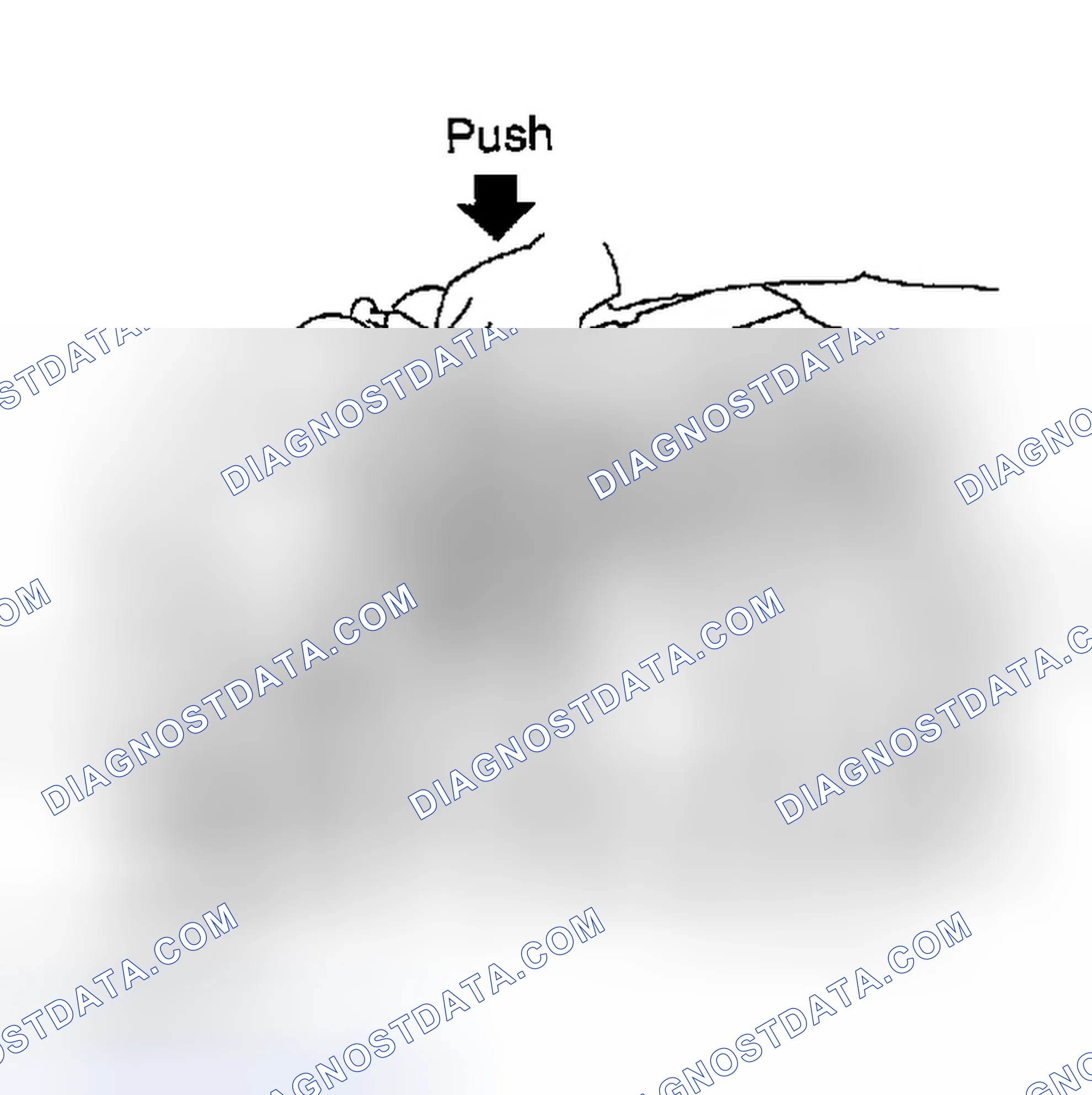 Scheme 38: MEASUREMENT OF COMPRESSION PRESSURE