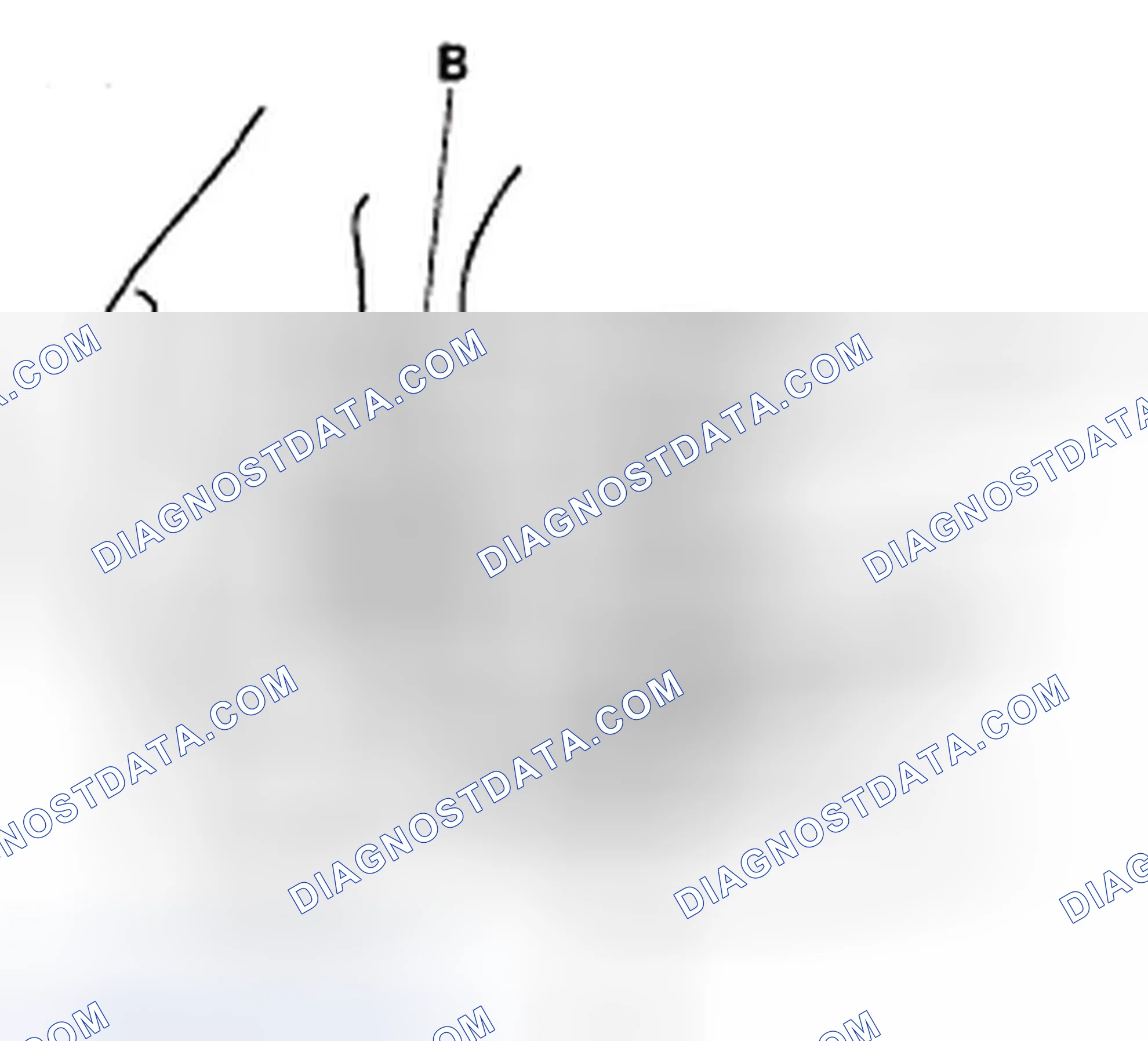 Scheme 3: Overrunning Clutch Inspection