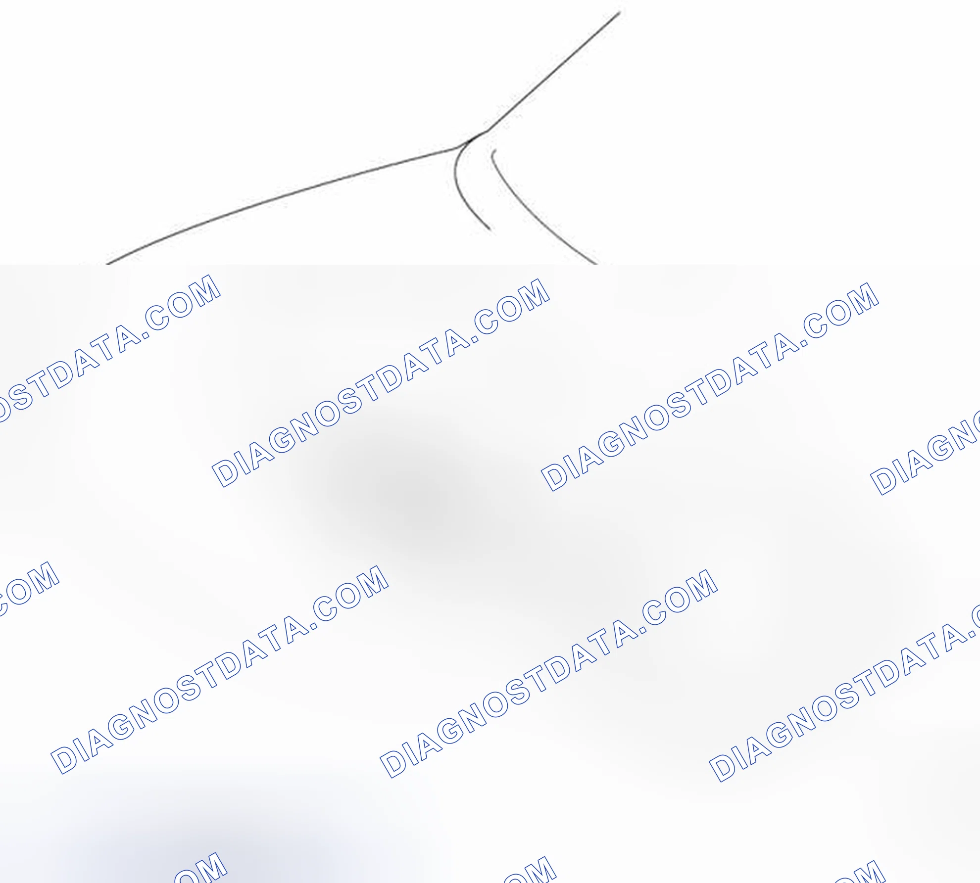 Scheme 30: Engine Mounting