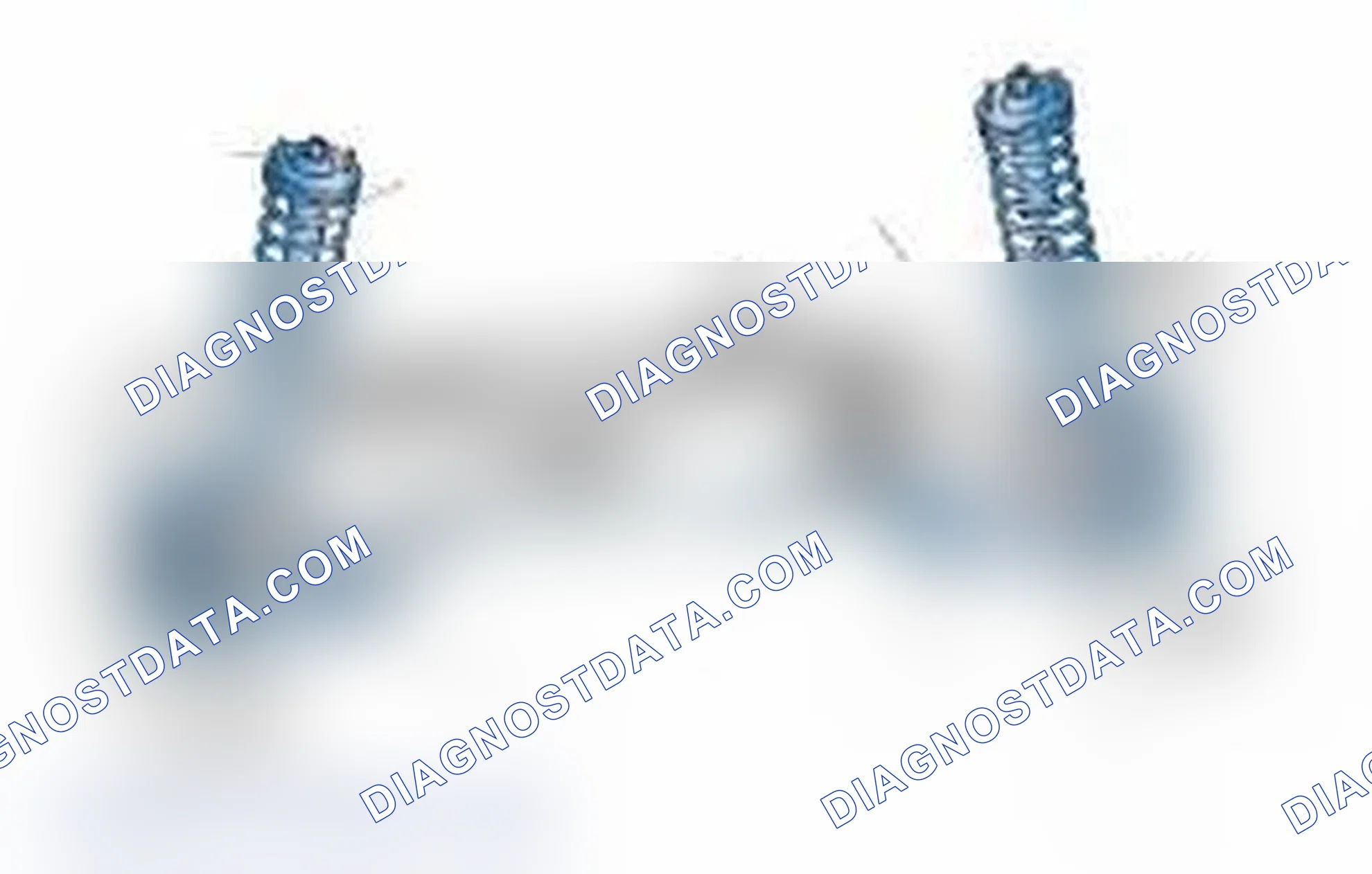 Scheme 25: Typical Front Suspension & Steering Components