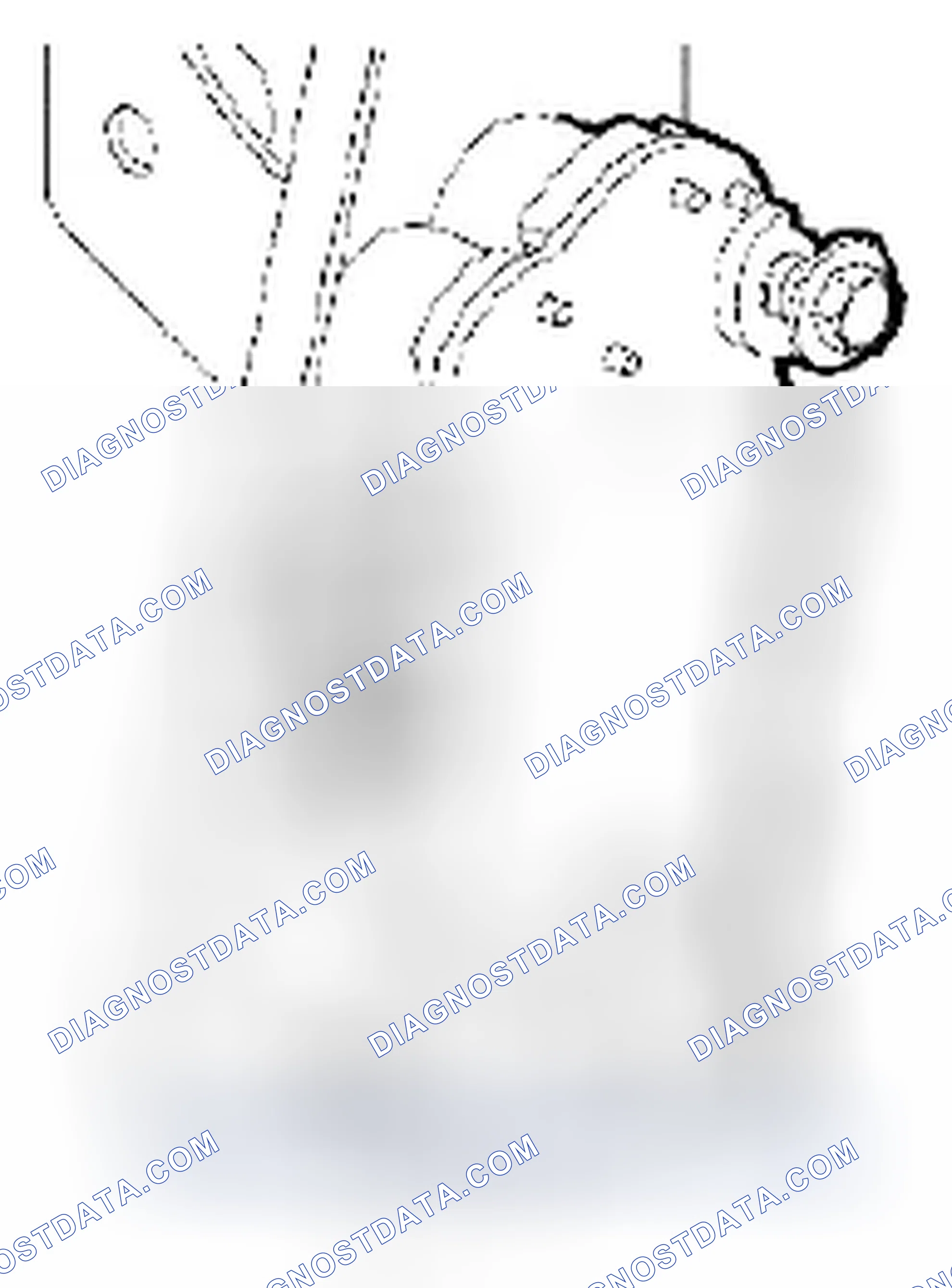 Scheme 25: Installation Procedure
