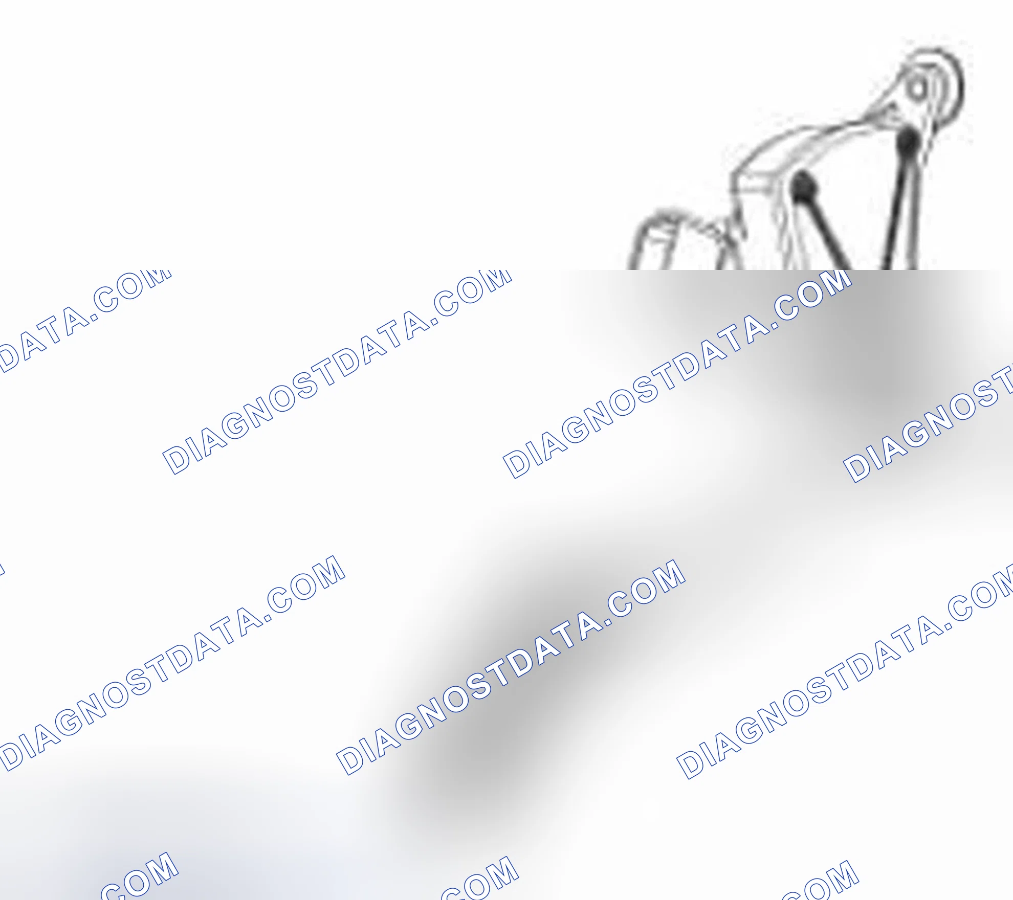 Scheme 18: 3-Track APP Sensor