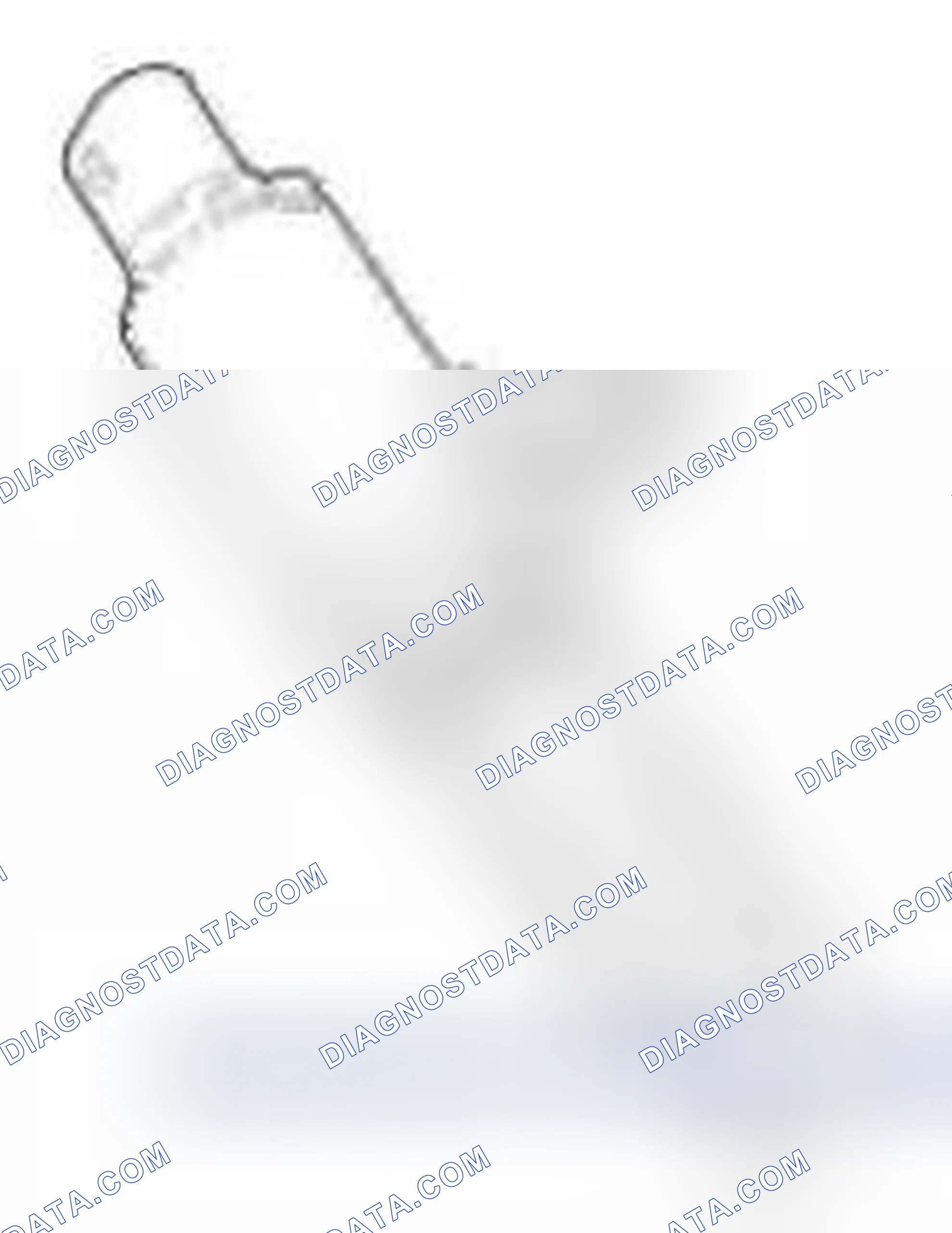 Scheme 209: (Bank 1/Intake)