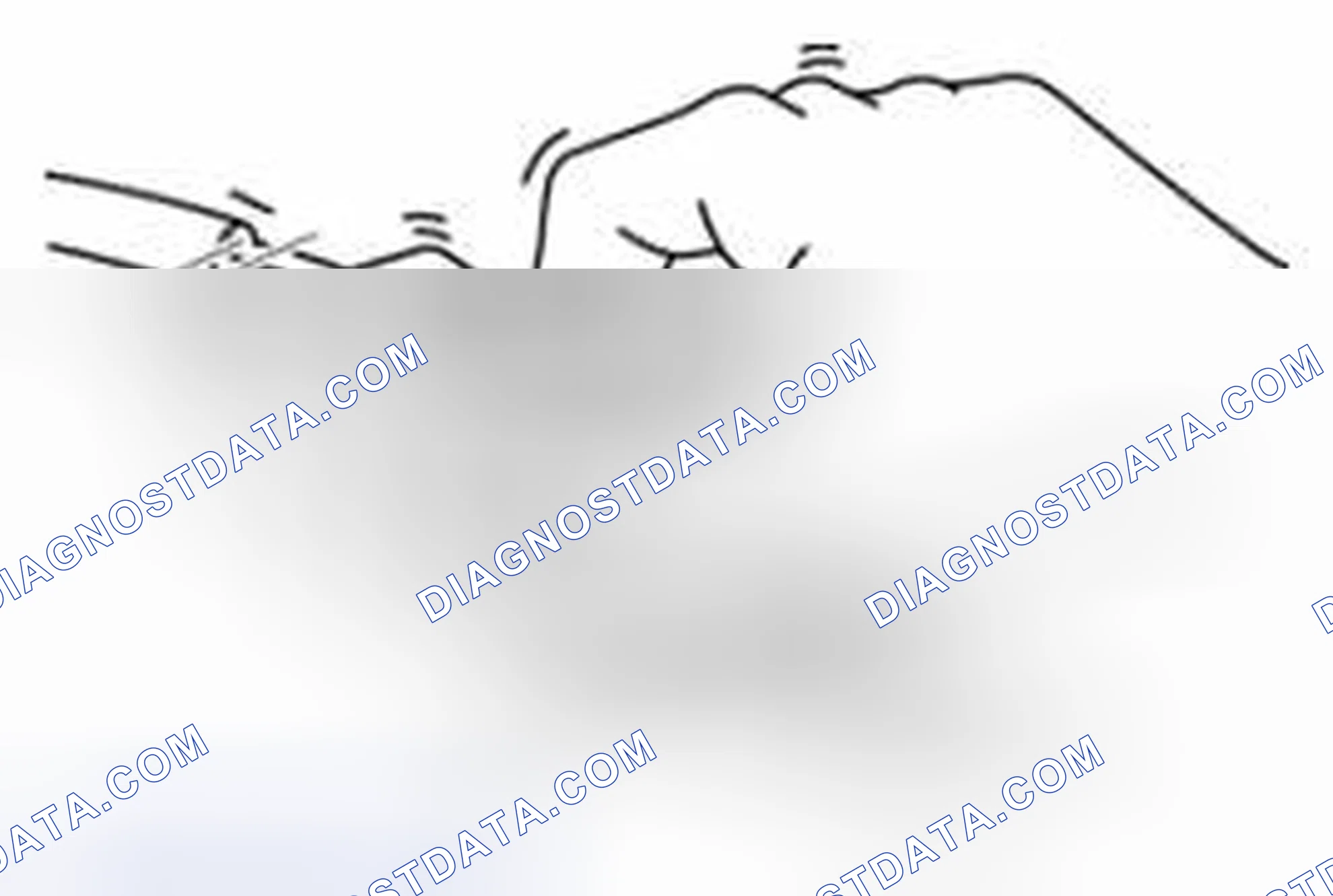 Scheme 189: Action for Non-repeatable Malfunction