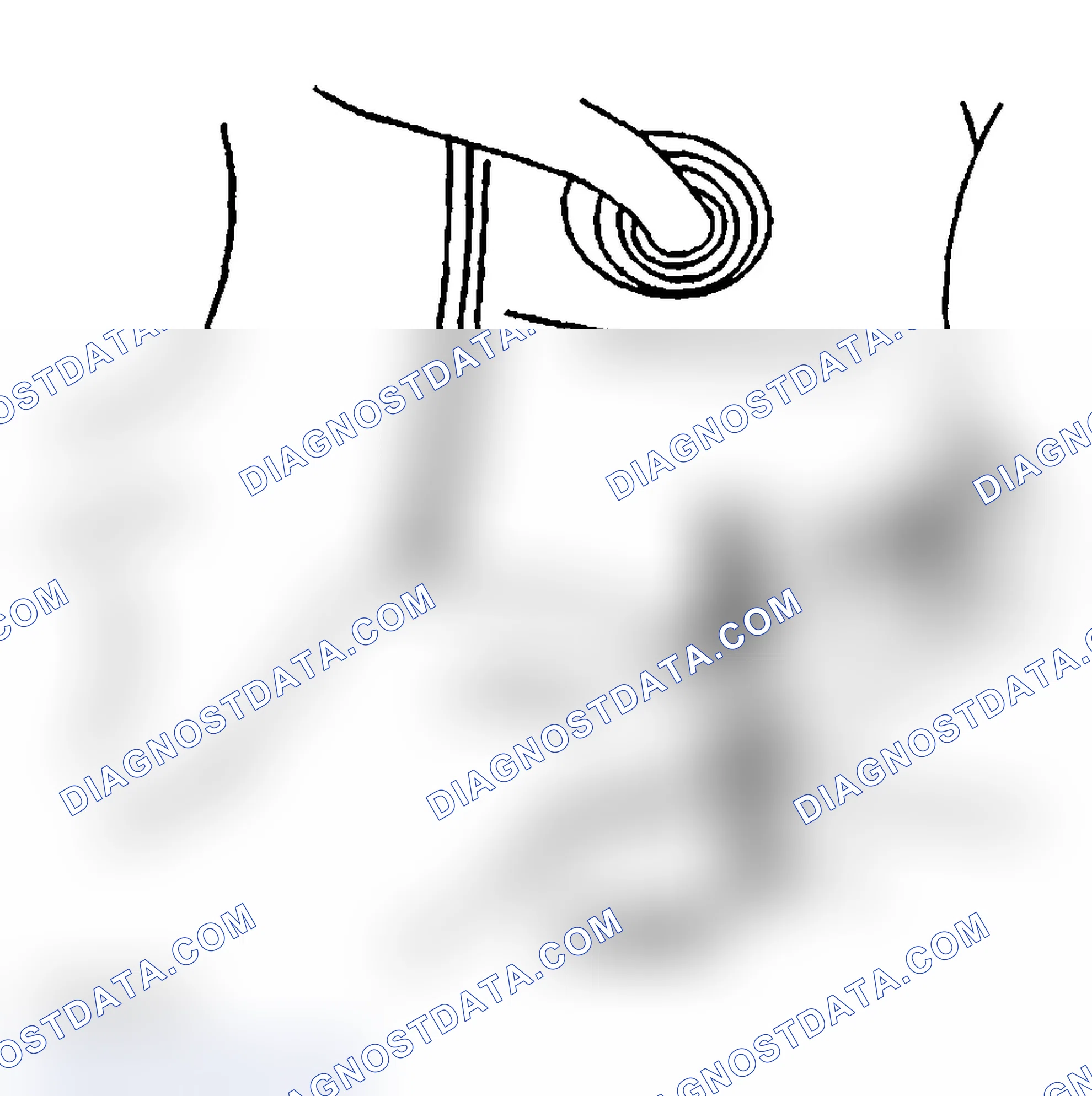 Scheme 19: Removal Procedure