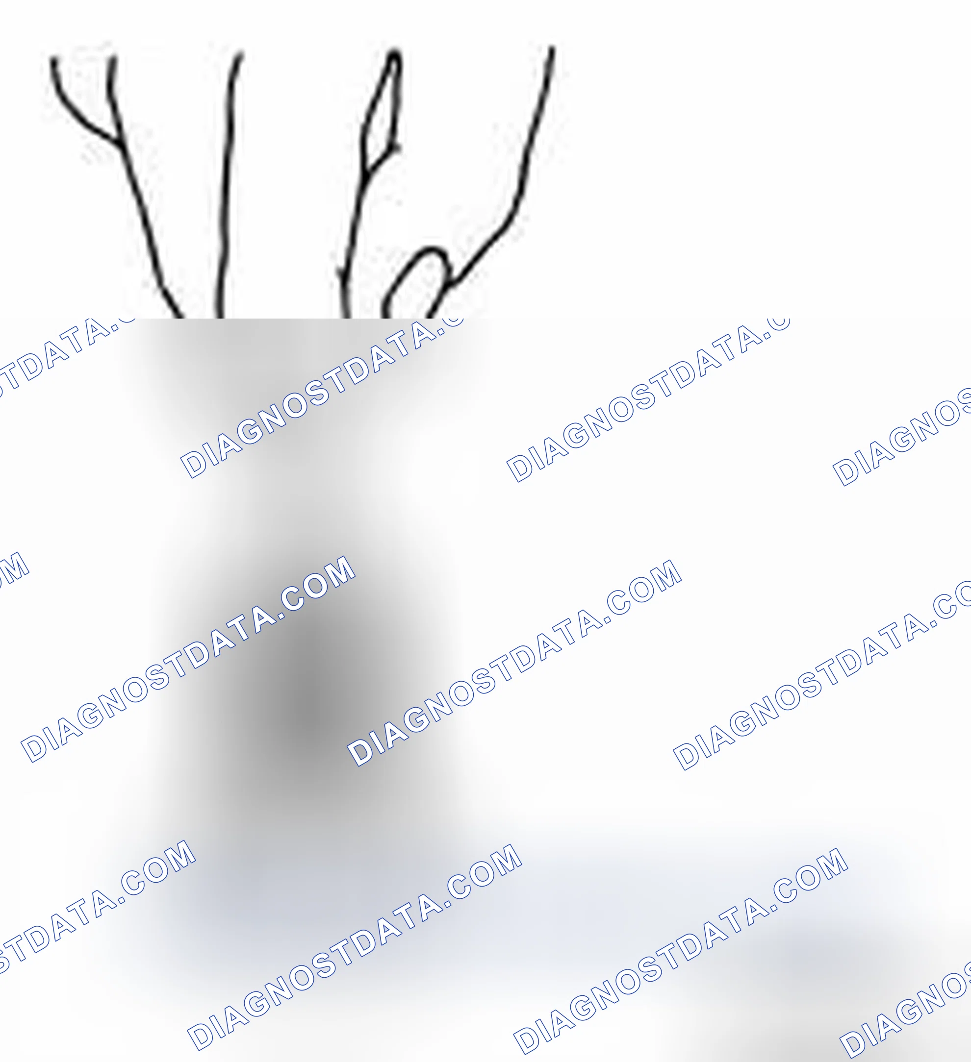 Scheme 306: OIL JET RELIEF VALVE