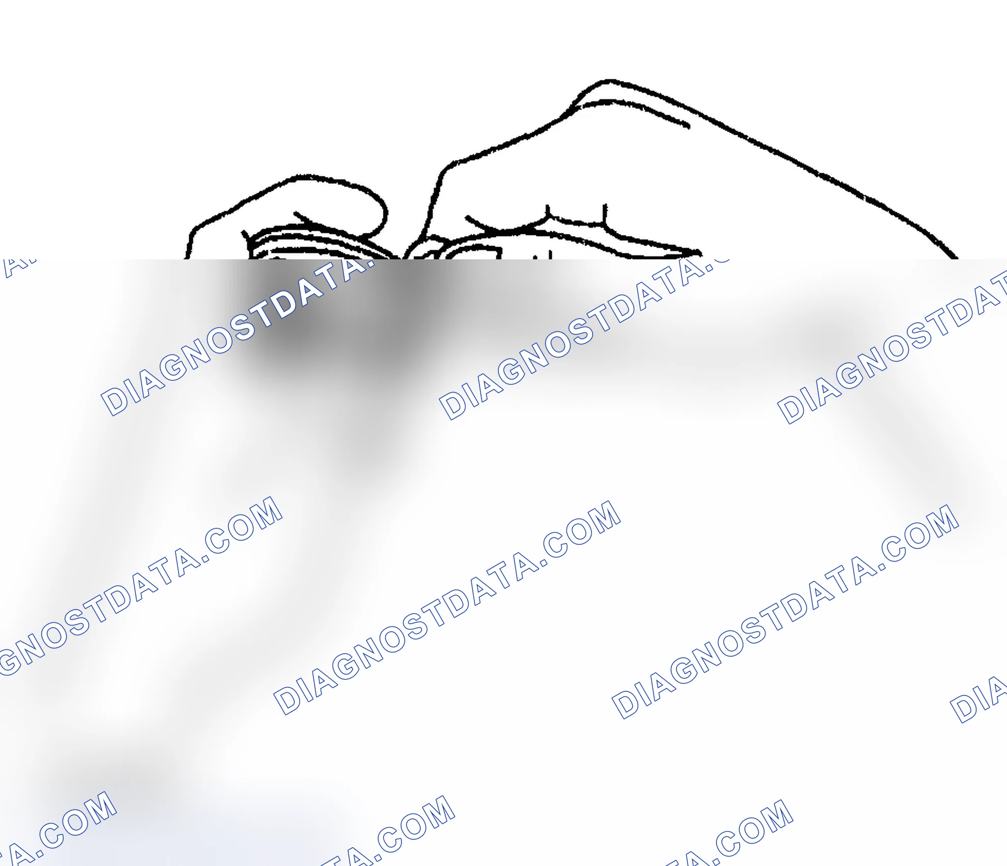 Scheme 10: Removal Procedure