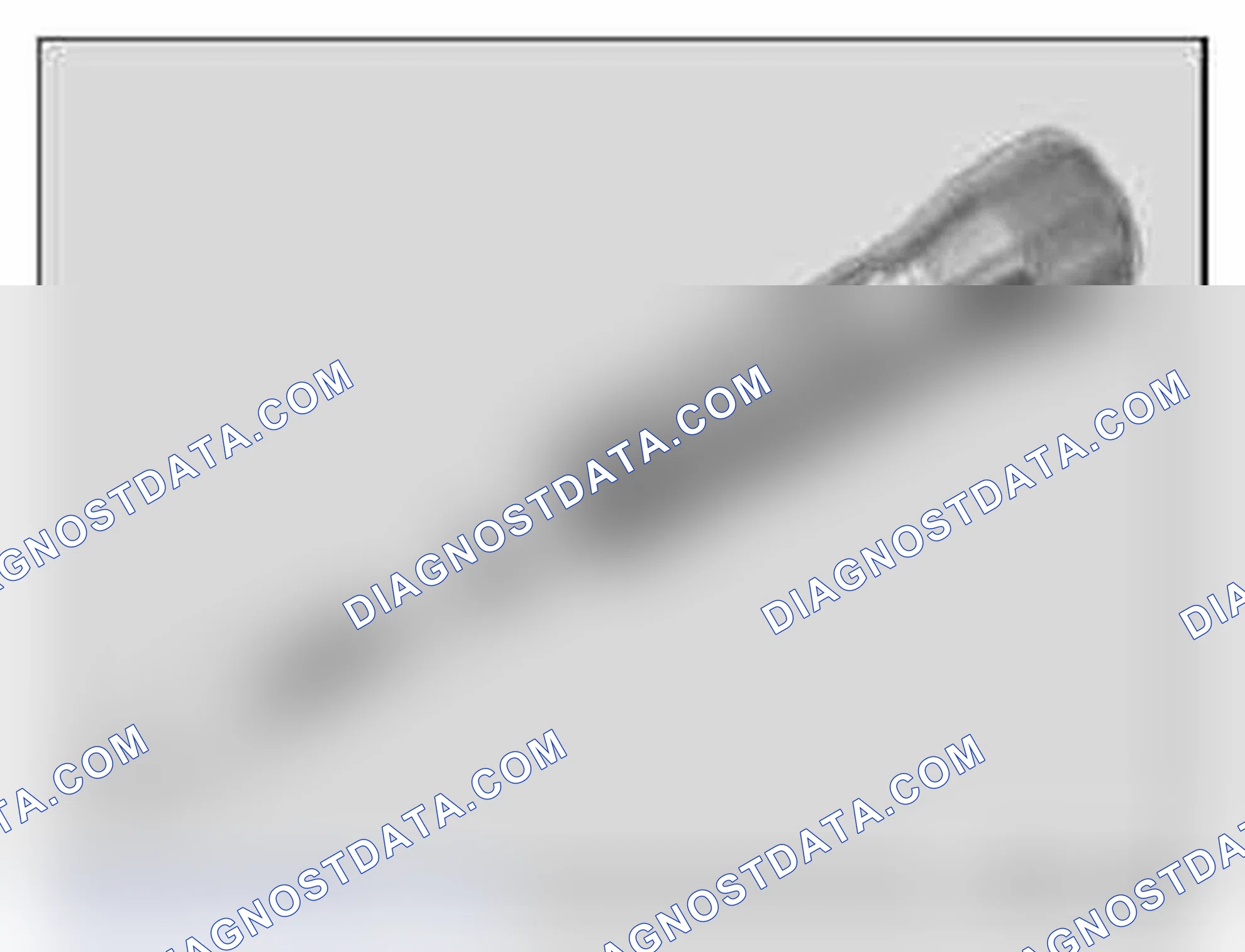 Scheme 169: 00 9 450 Torque wrench