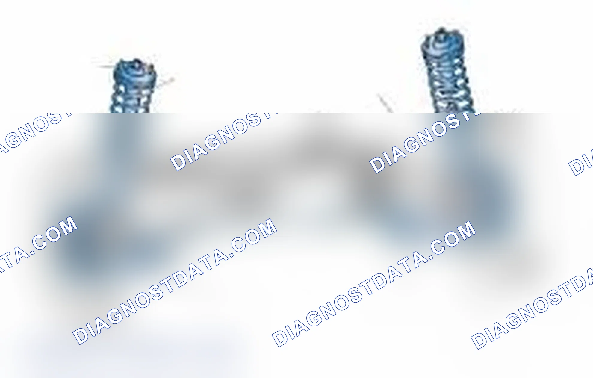 Scheme 25: Typical Front Suspension & Steering Components