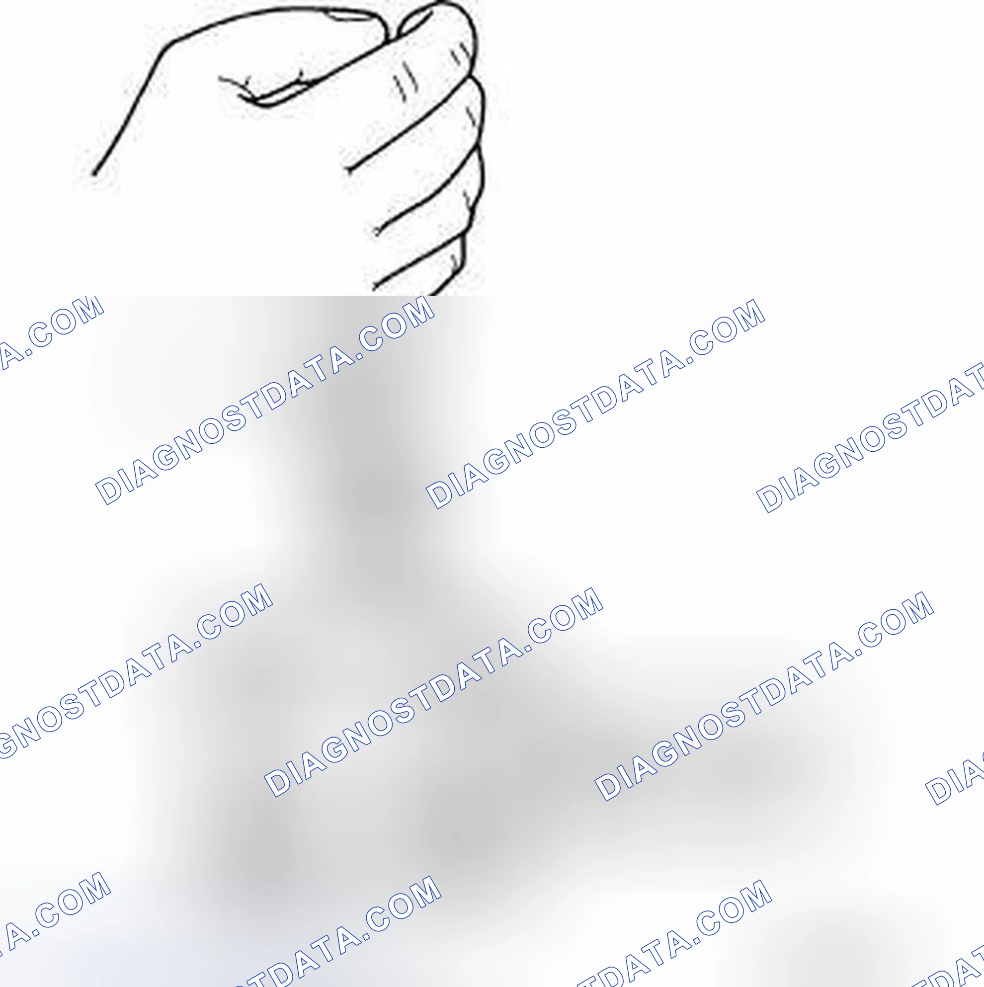 Scheme 37: DISASSEMBLY