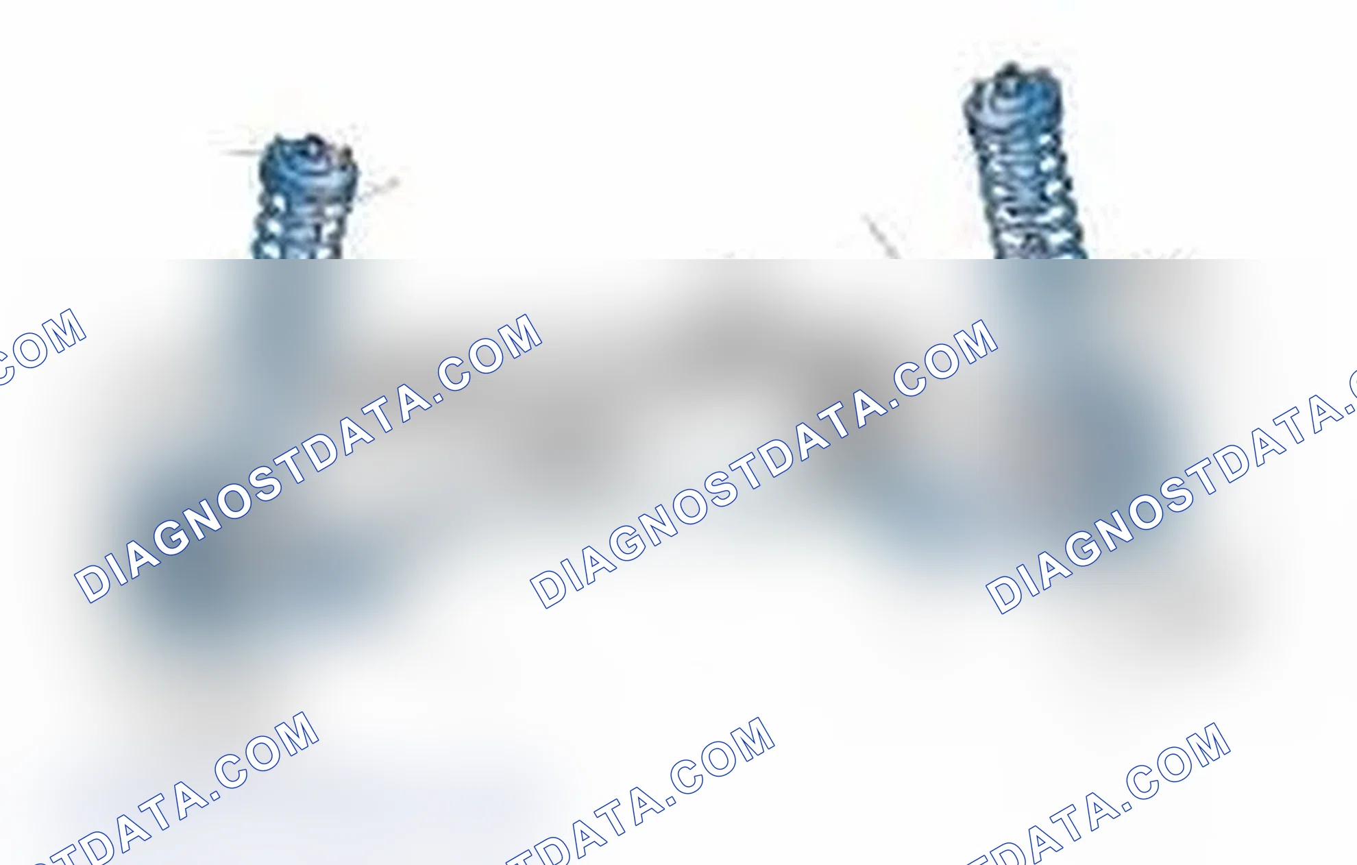 Scheme 25: Typical Front Suspension & Steering Components