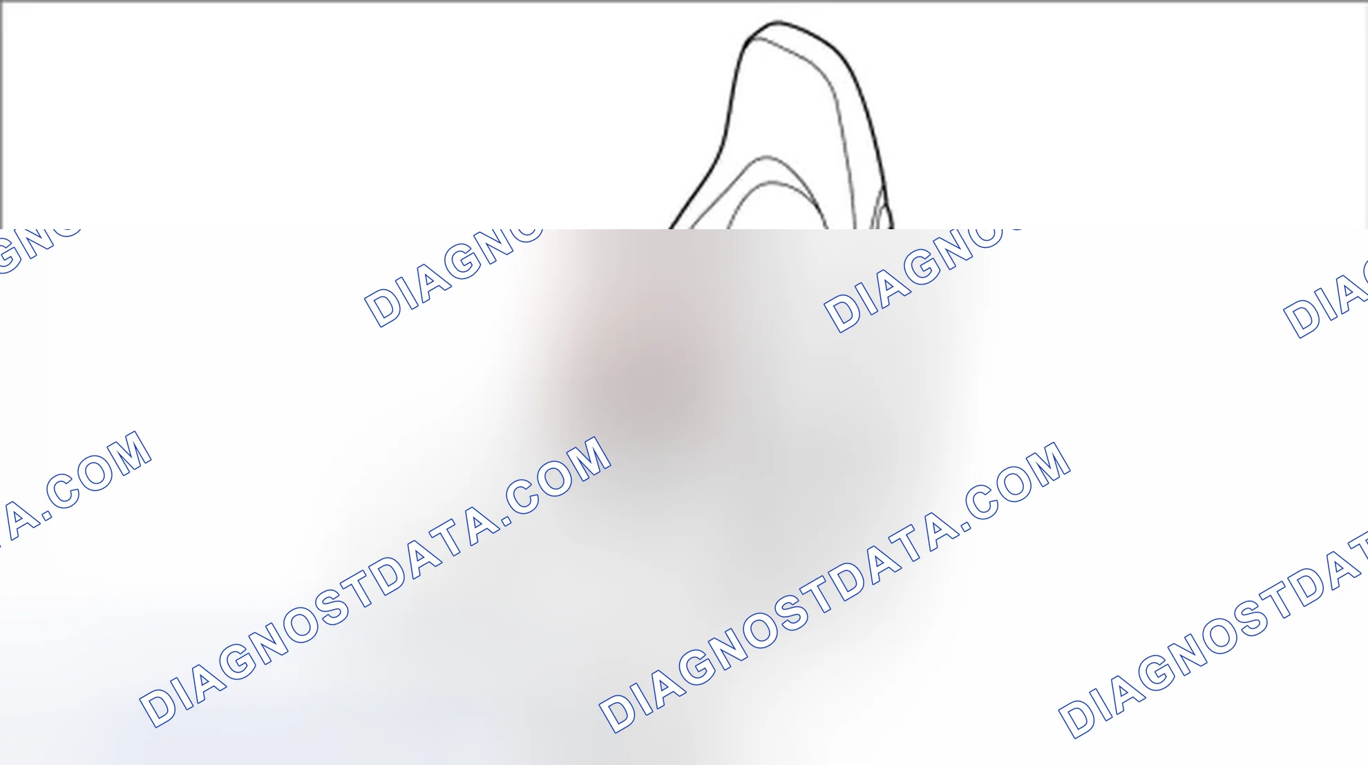 Scheme 83: Removing air cushion for backrest