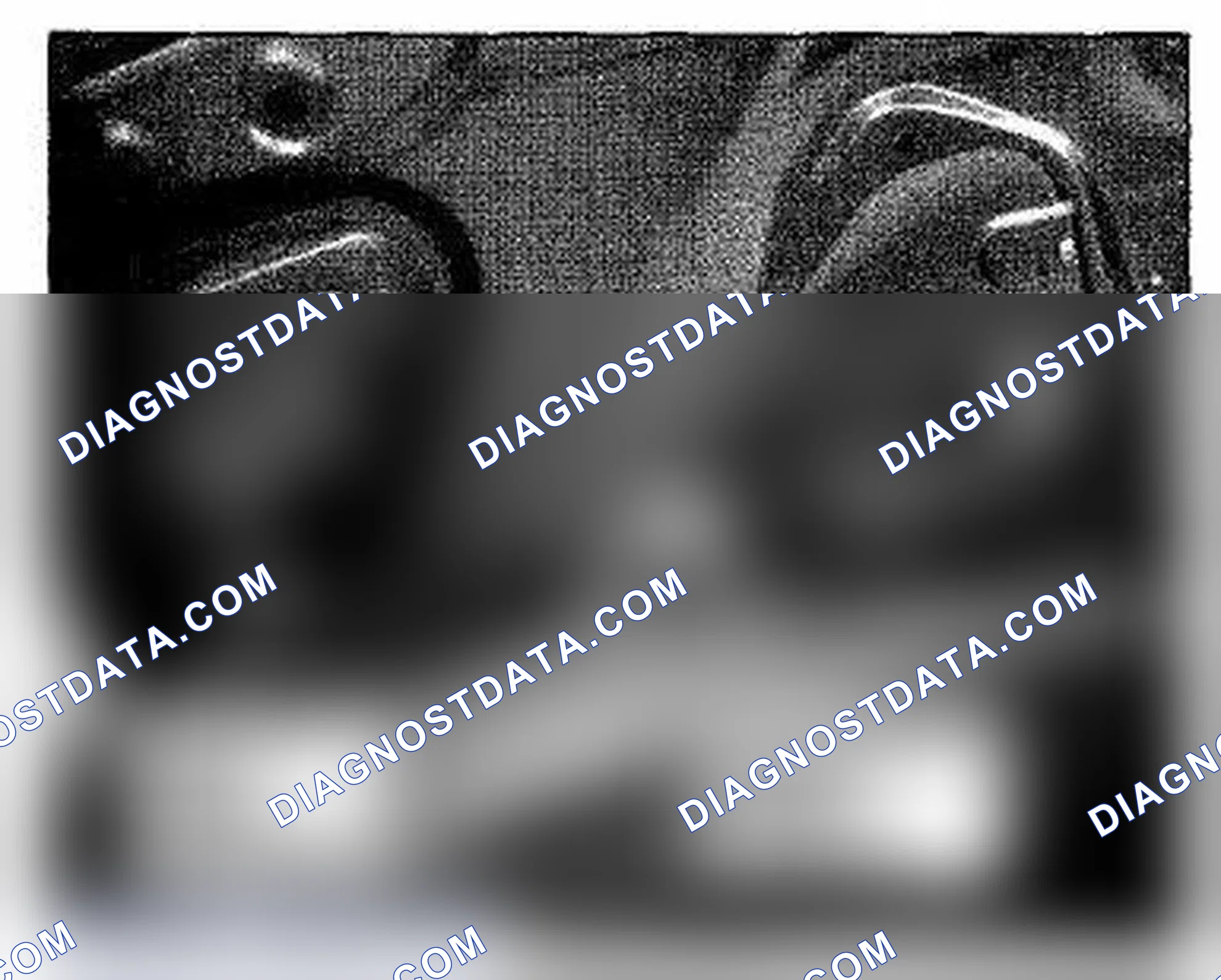 Scheme 552: Left Side Of Trunk Lid Component Location (Photo 165)