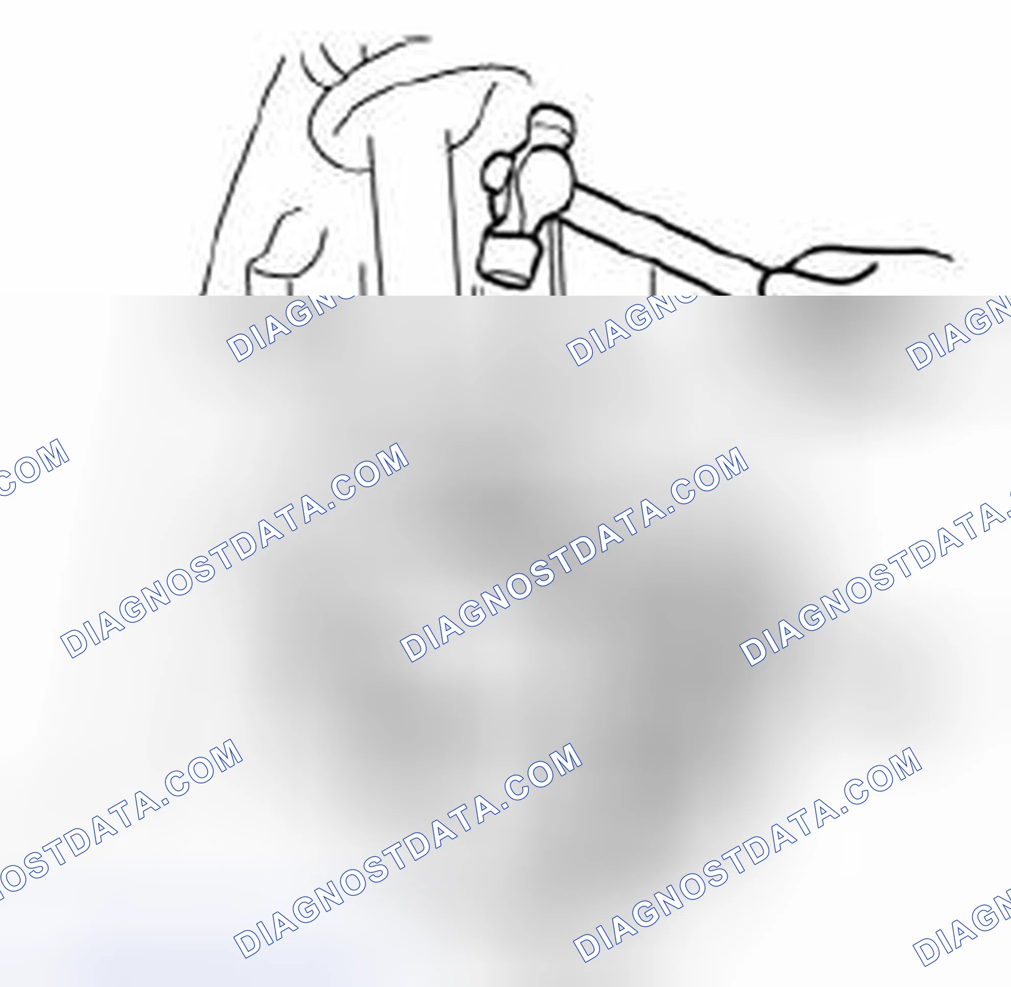 Scheme 5: Front Shock Absorber and Coil Spring Removal Note