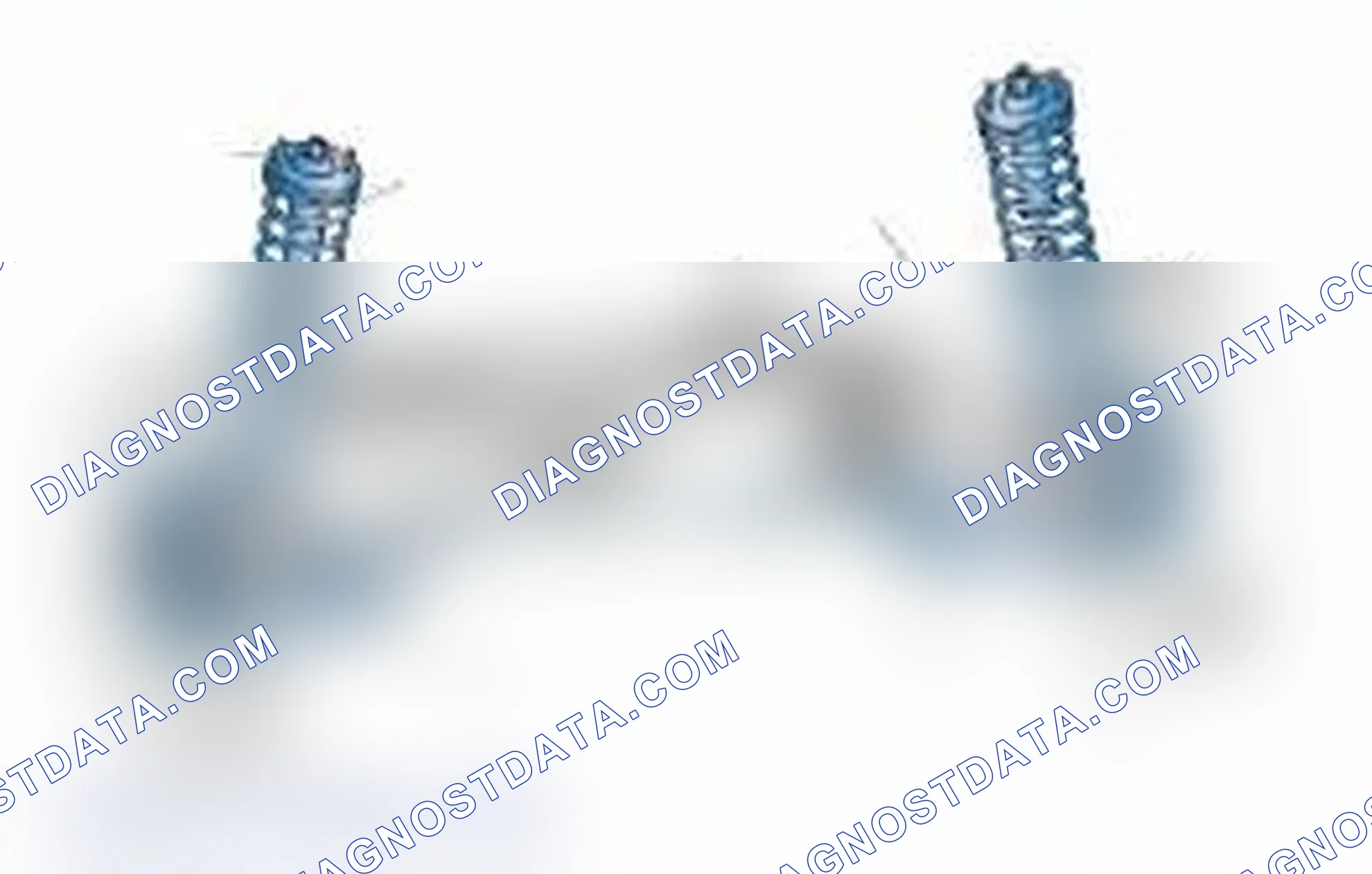 Scheme 25: Typical Front Suspension & Steering Components