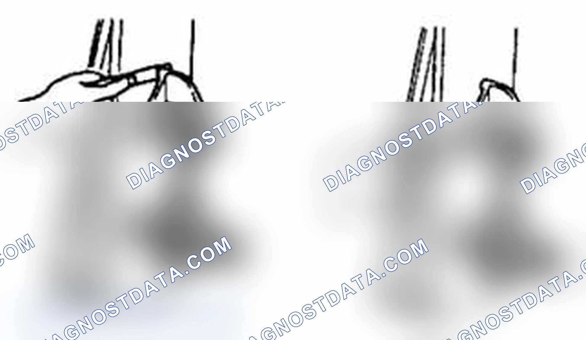 Scheme 452: Connecting rod alignment
