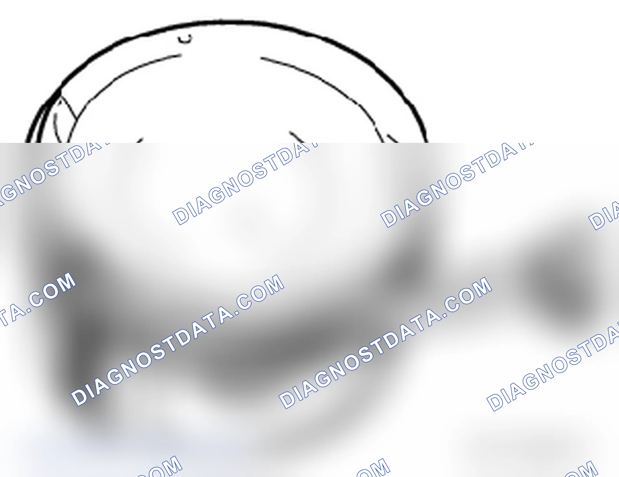 Scheme 411: Piston Ring Measurements
