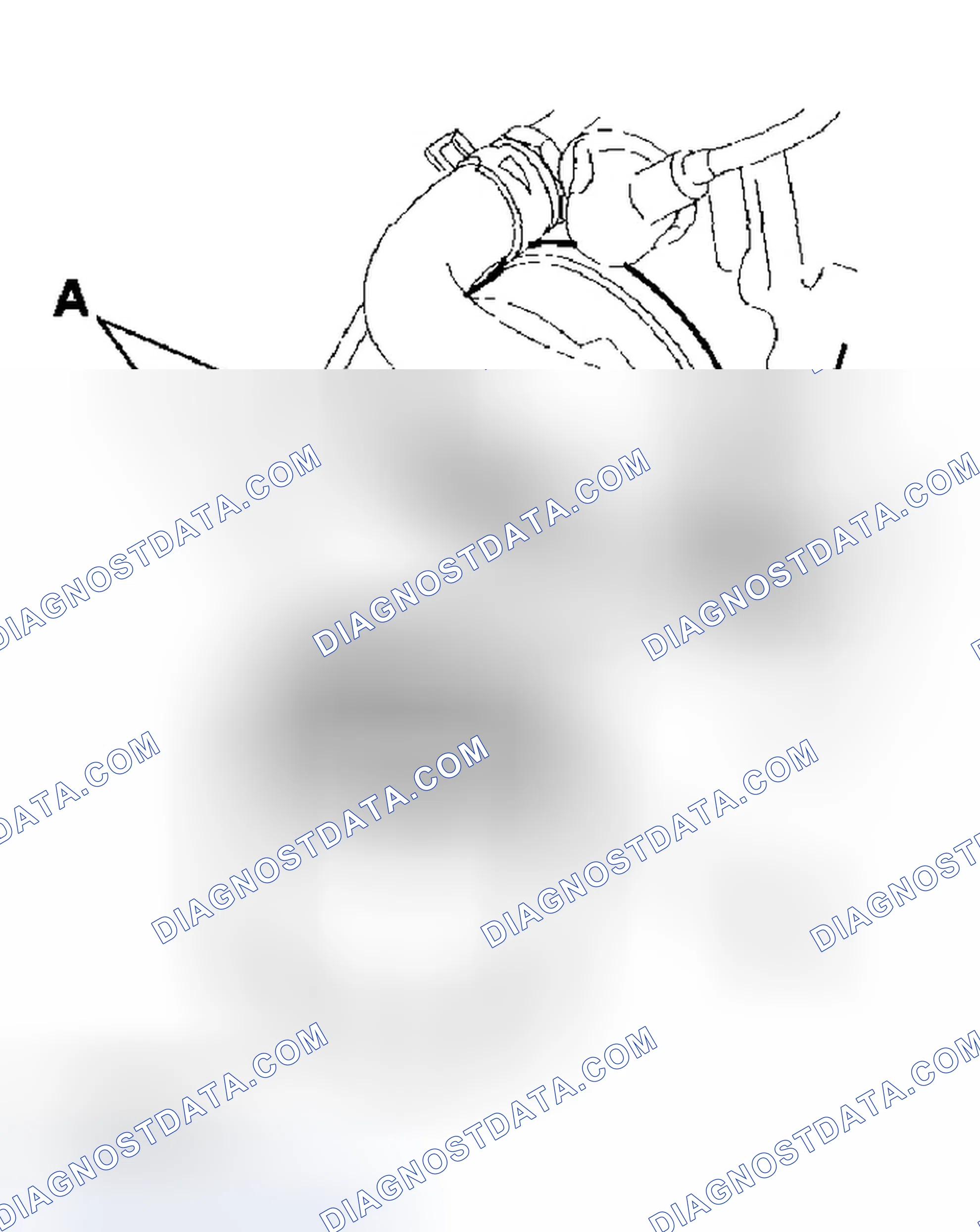 Scheme 7: Special Tools Required