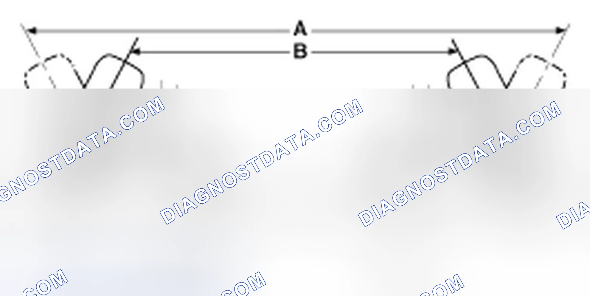 Scheme 2: Front Wheel Alignment