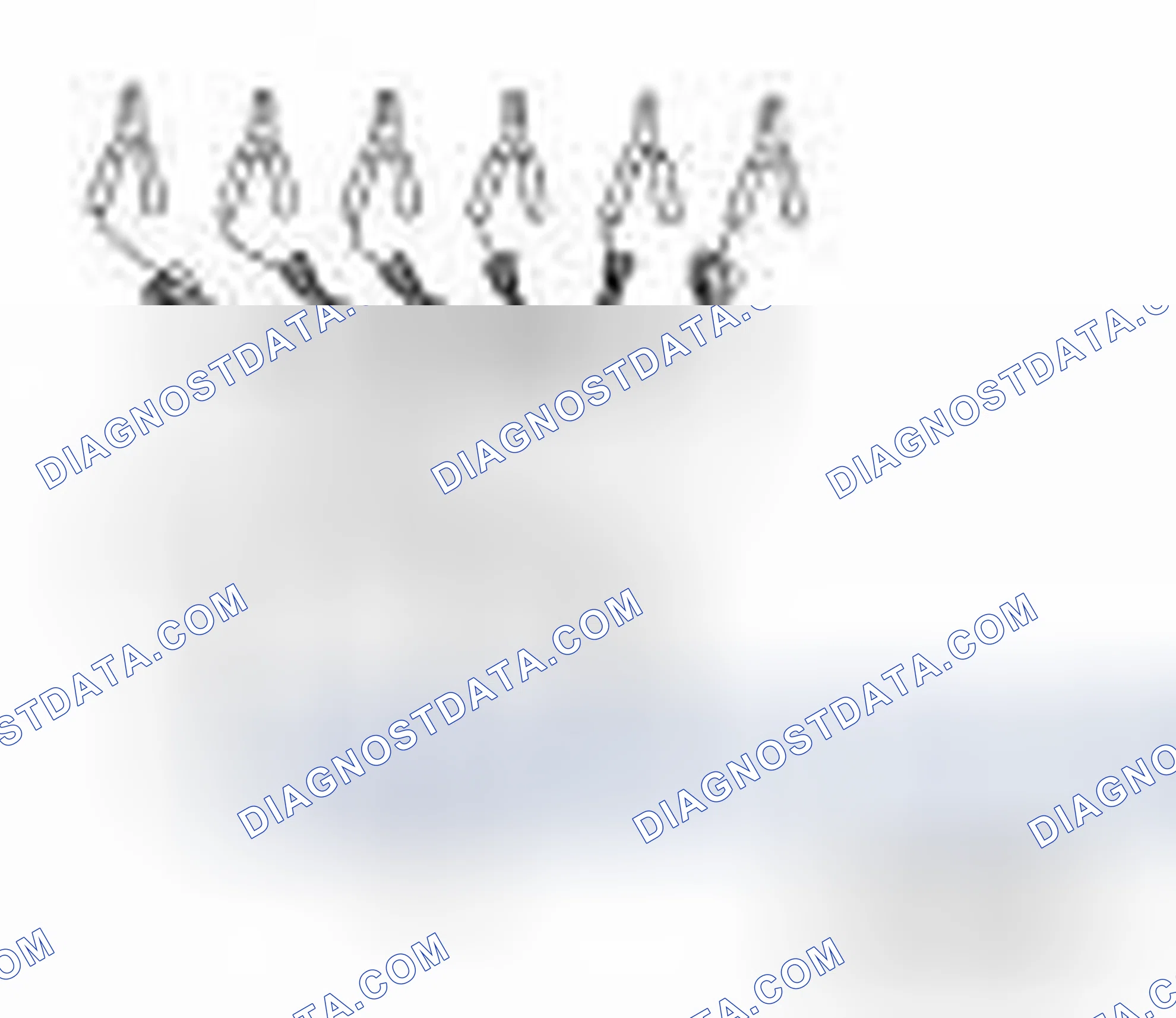 Scheme 33: Special Service Tools