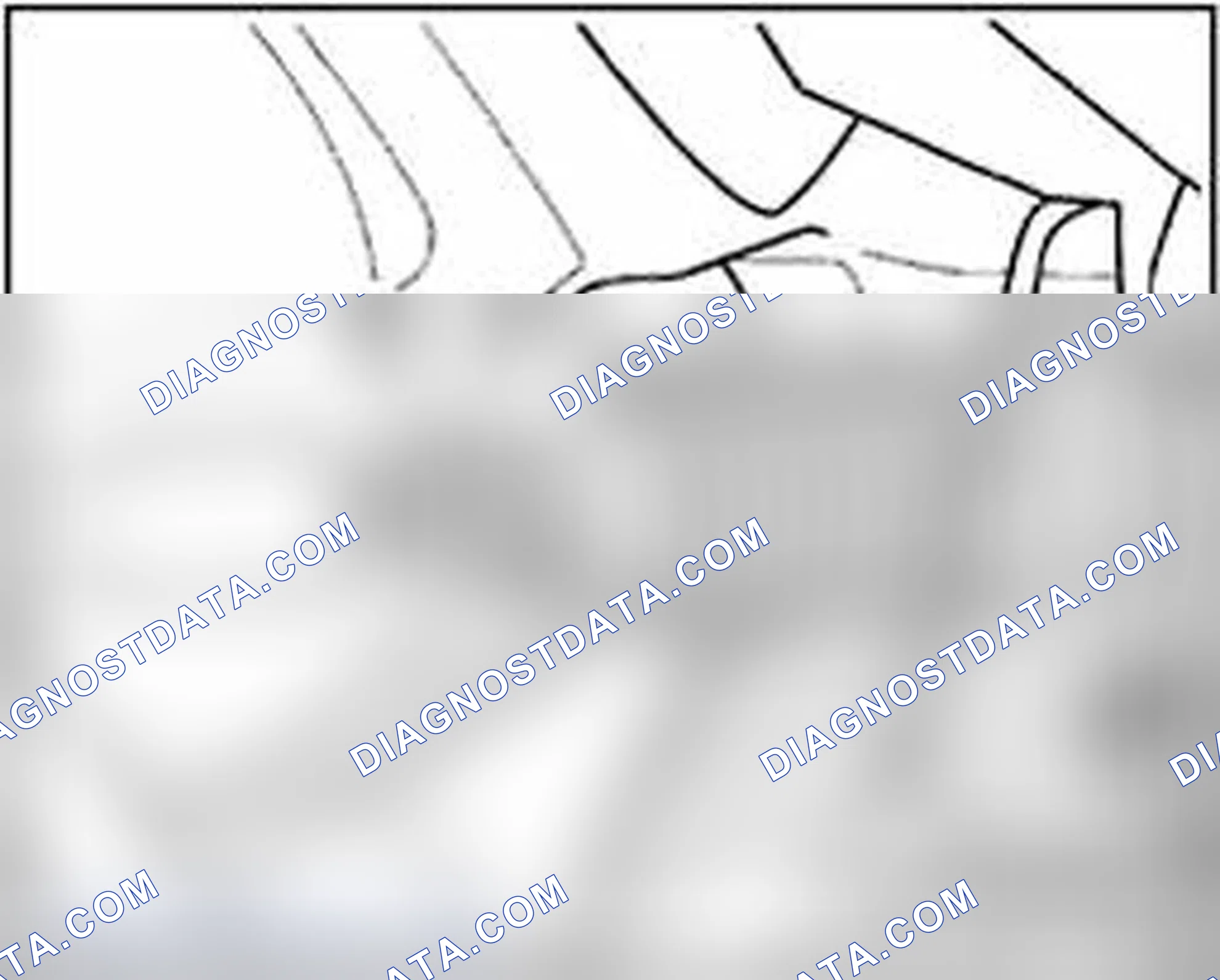 Scheme 309: Front Axle Toe, adjusting
