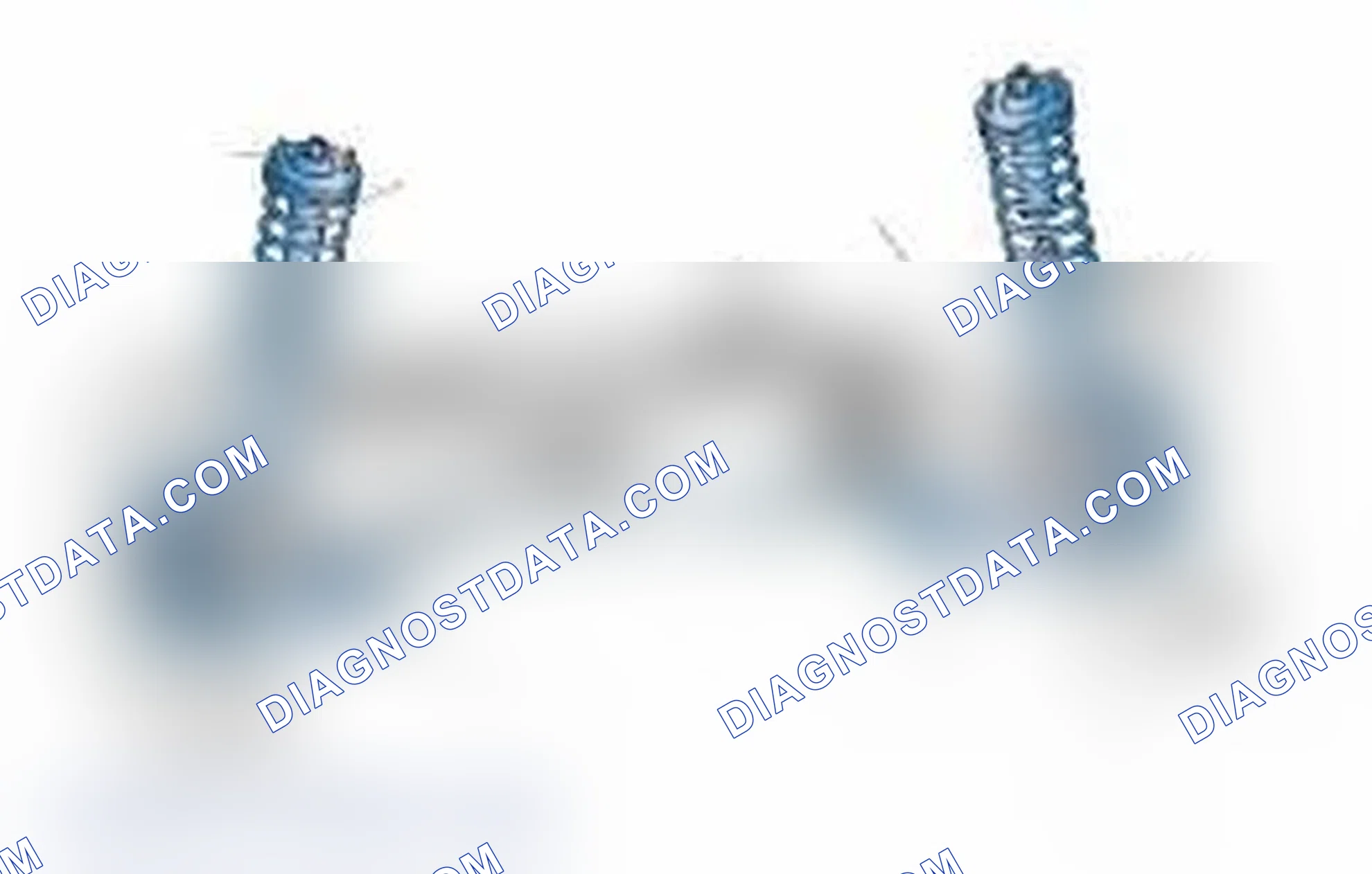 Scheme 25: Typical Front Suspension & Steering Components