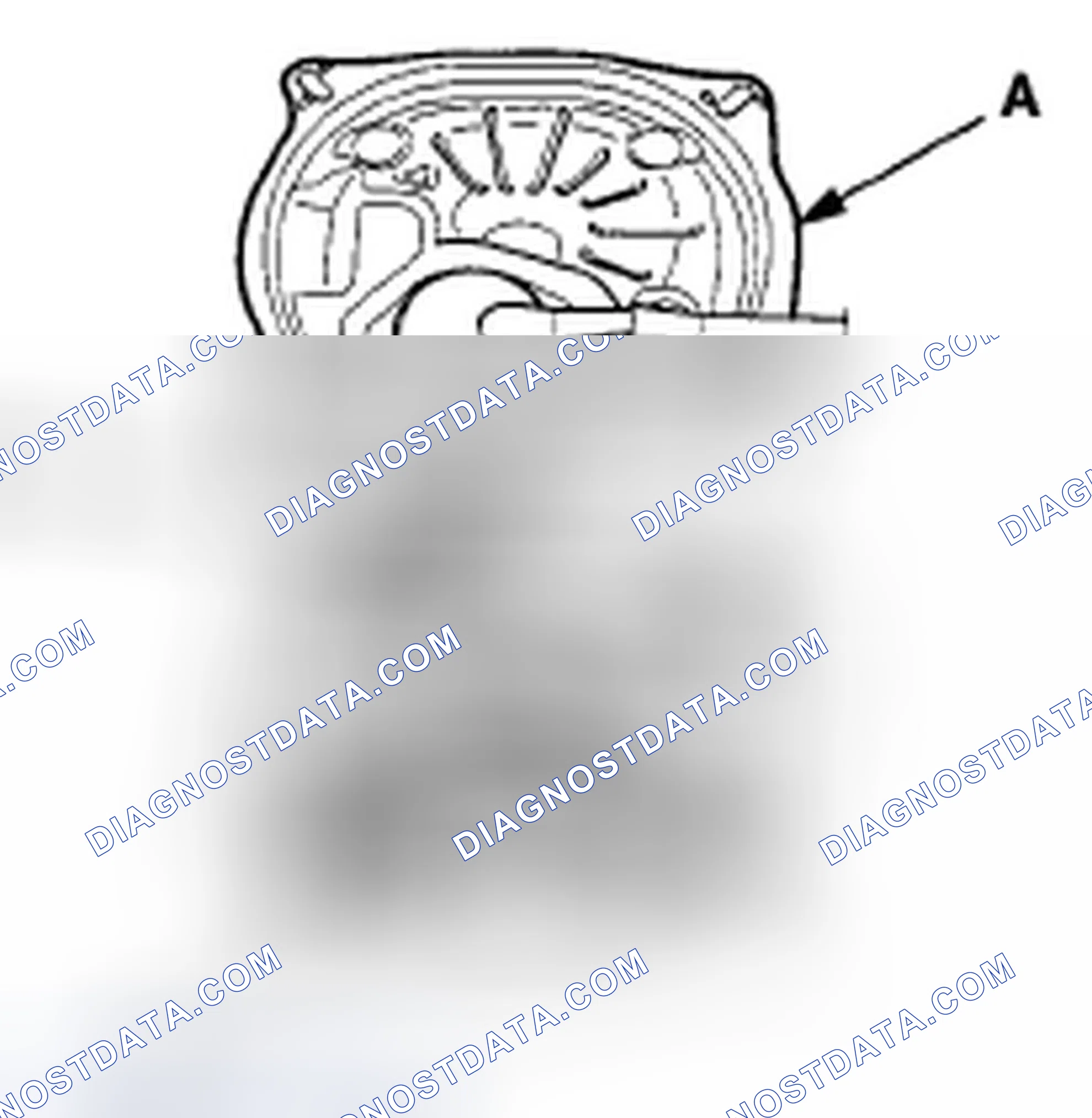 Scheme 317: Removal
