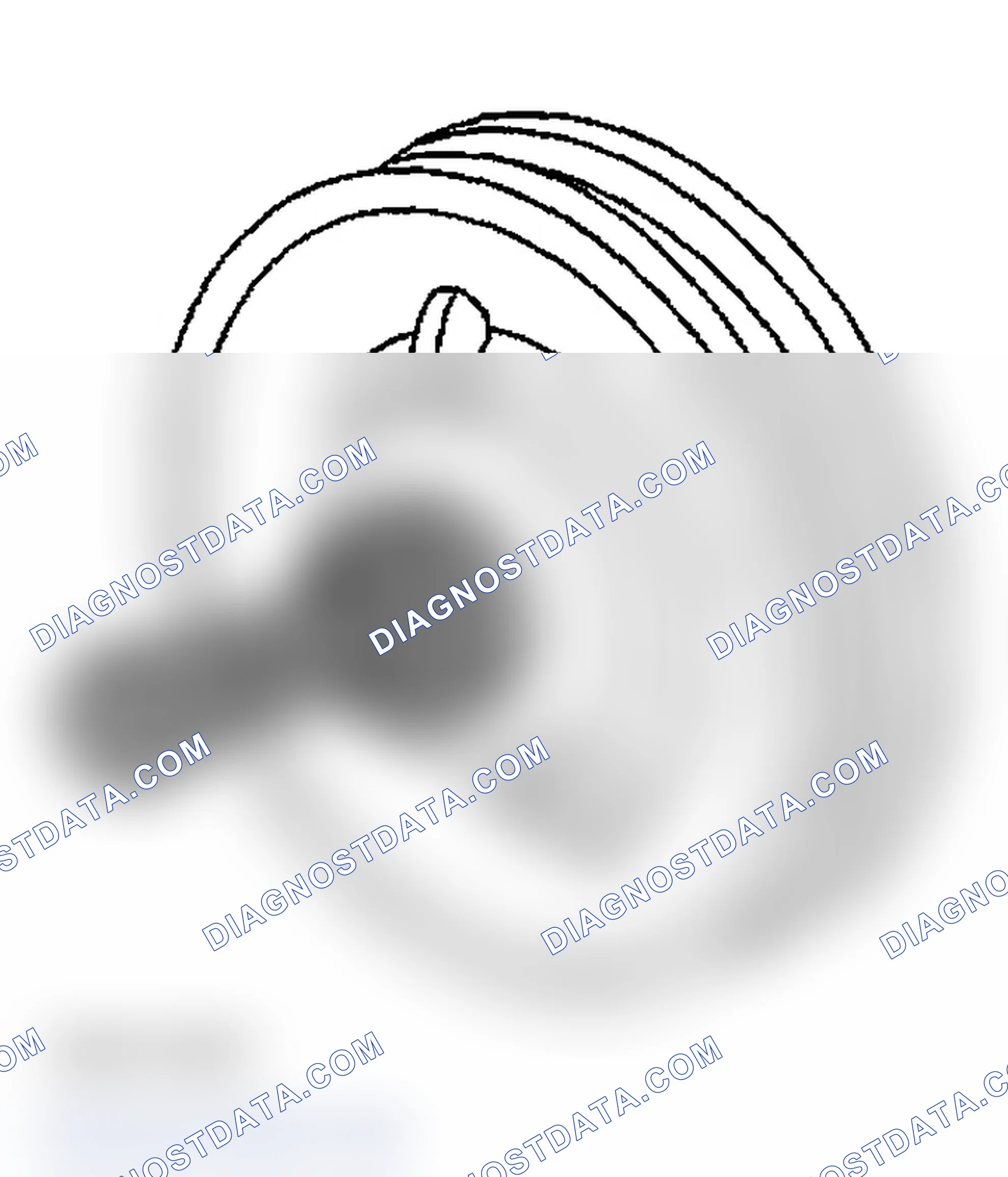Scheme 30: Installation Procedure