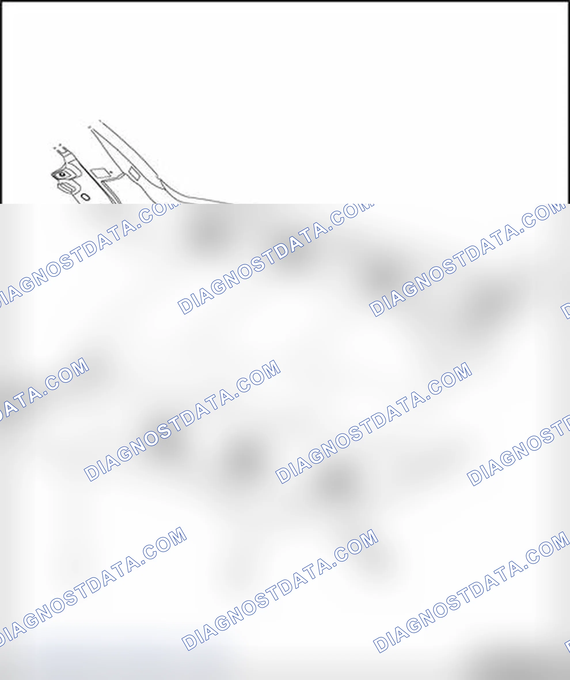 Scheme 183: Upper A-pillar trim, removing and installing