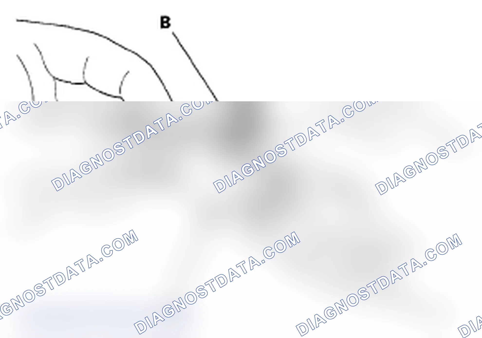 Scheme 18: Side Airbag Connector