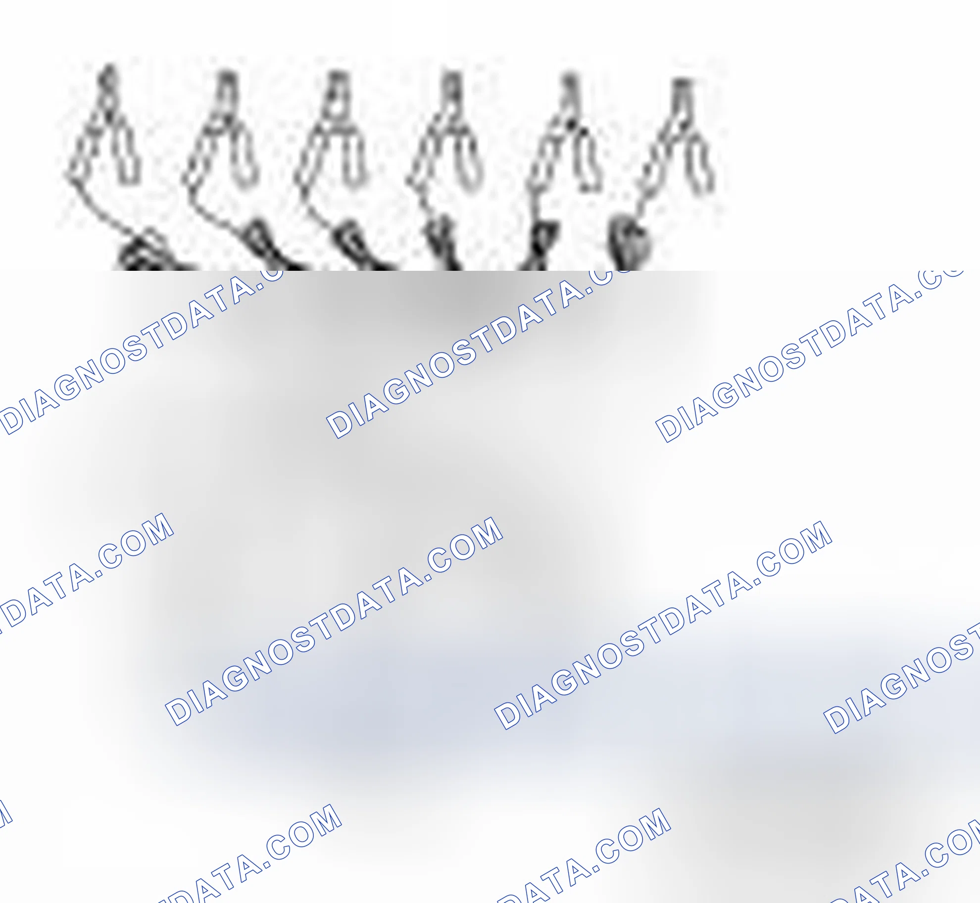 Scheme 47: Special Service Tool