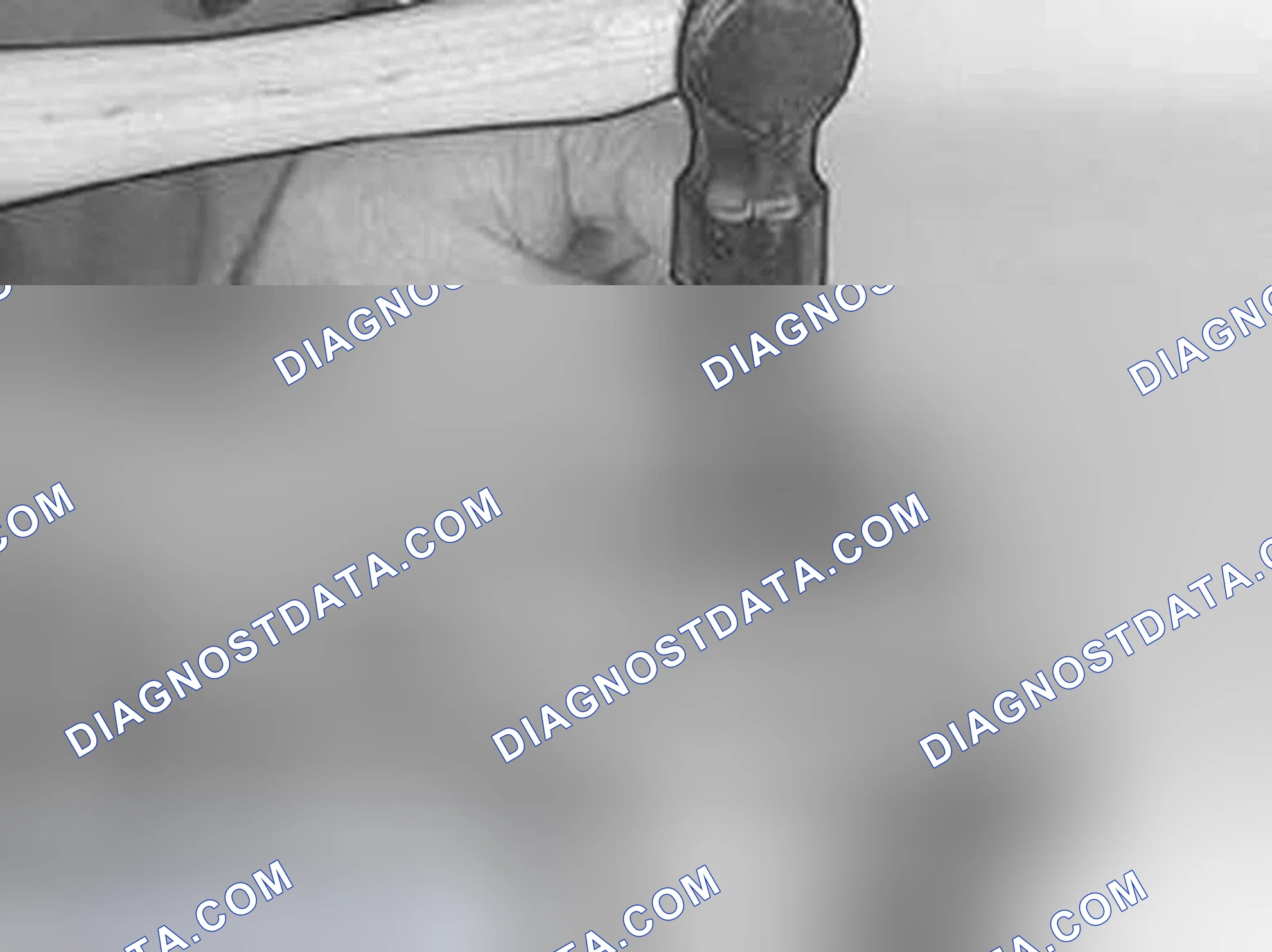 Scheme 461: Marking The Connecting Rod (Where Applicable)