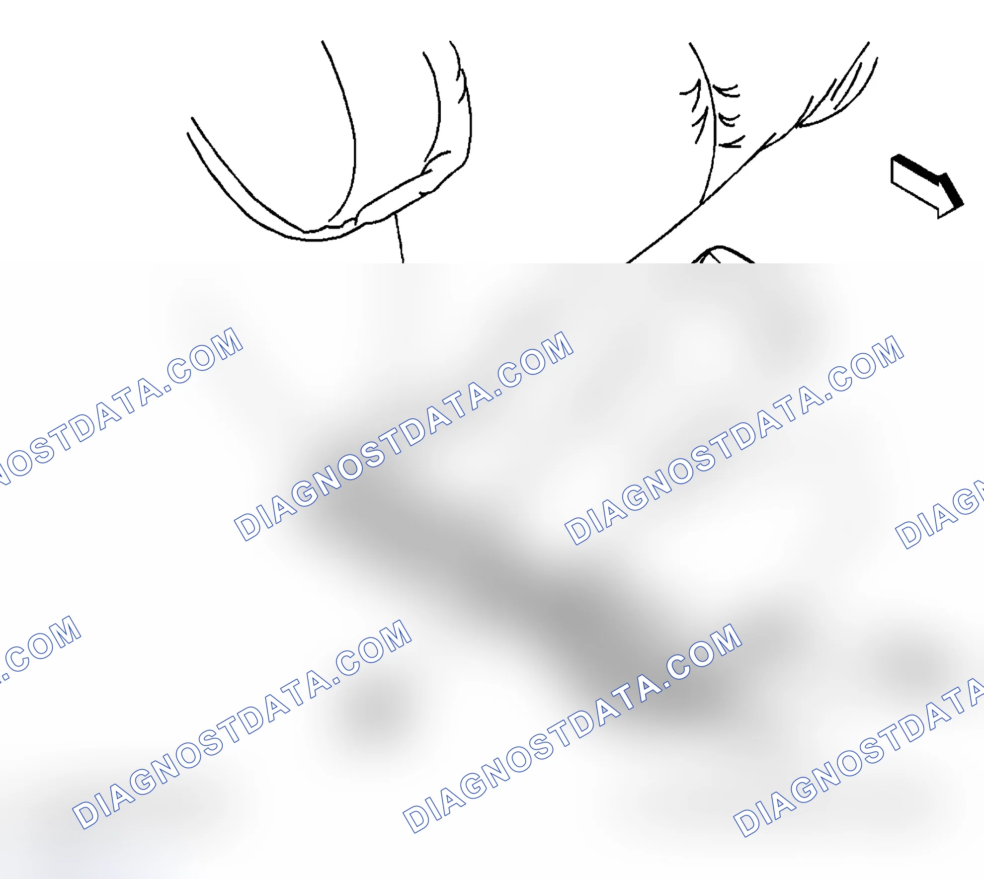 Scheme 2: Seat Belt Component Views