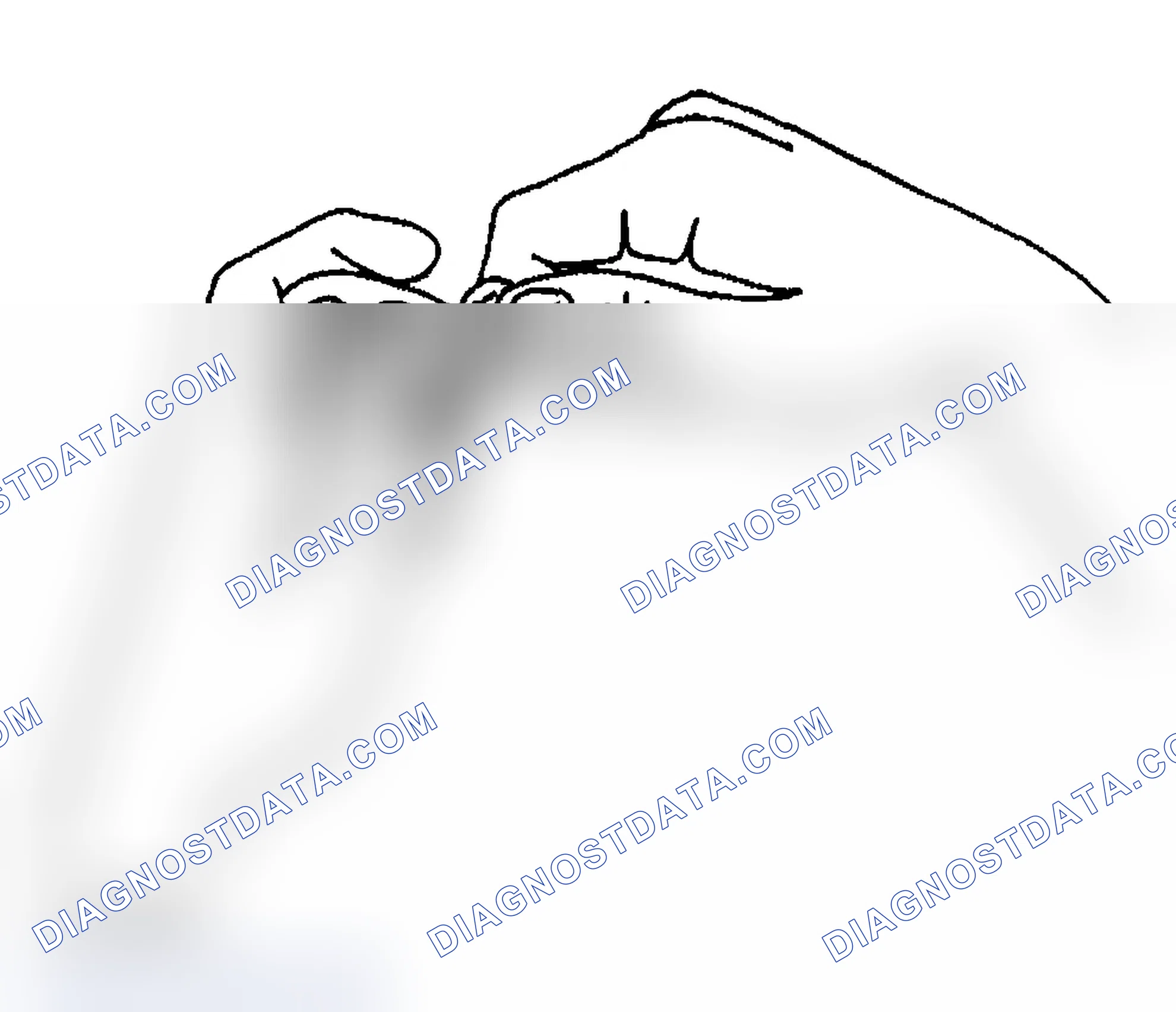 Scheme 9: Removal Procedure