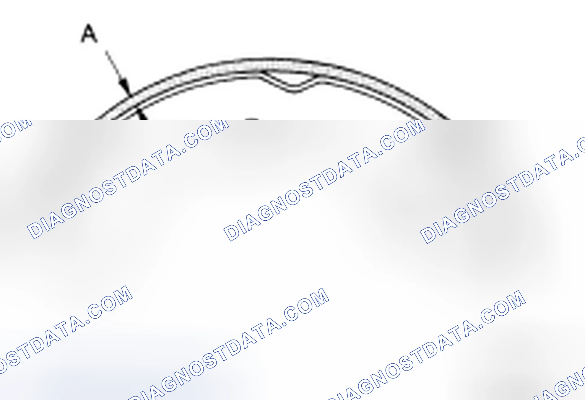 Scheme 41: LINING