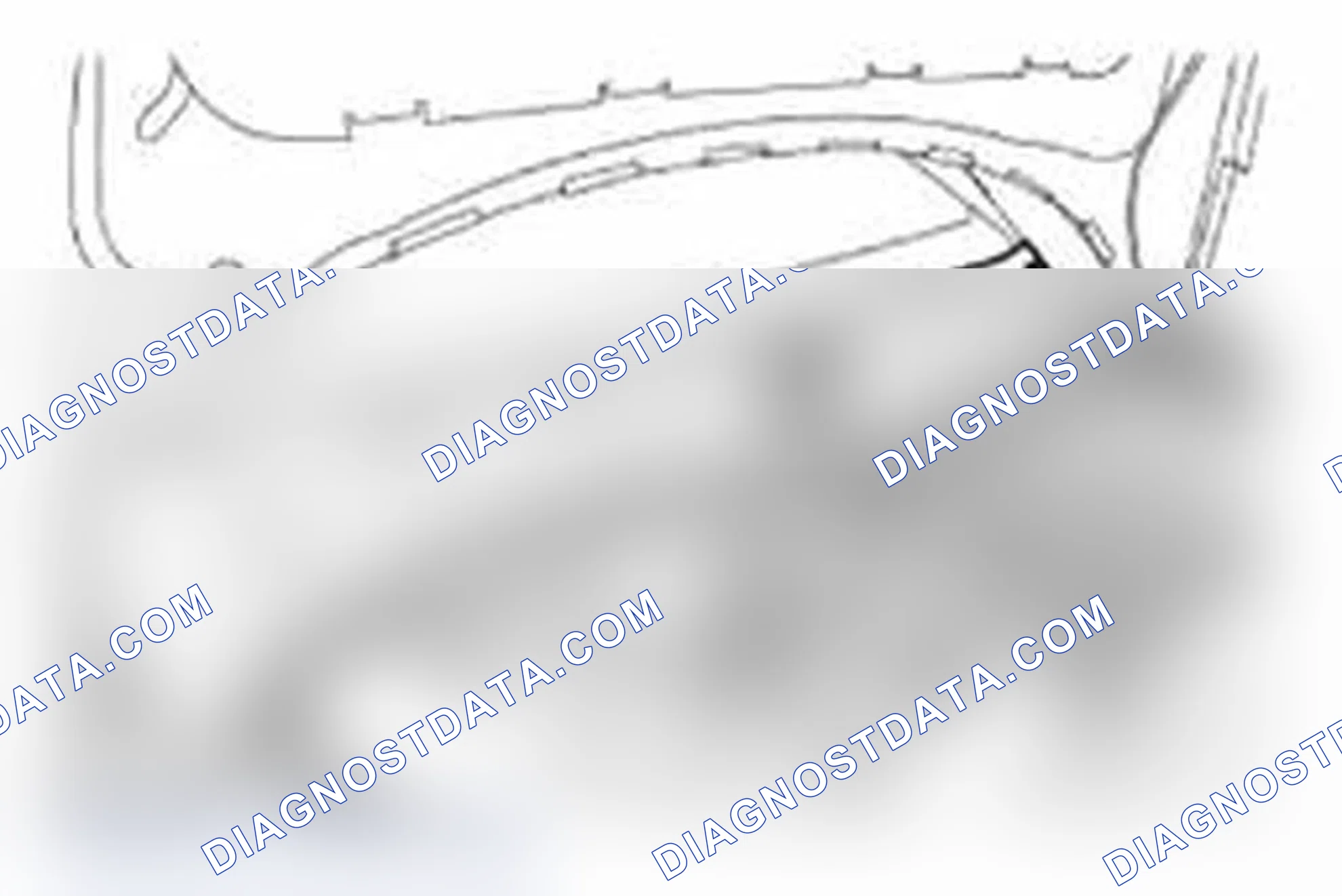 Scheme 5: REMOVAL