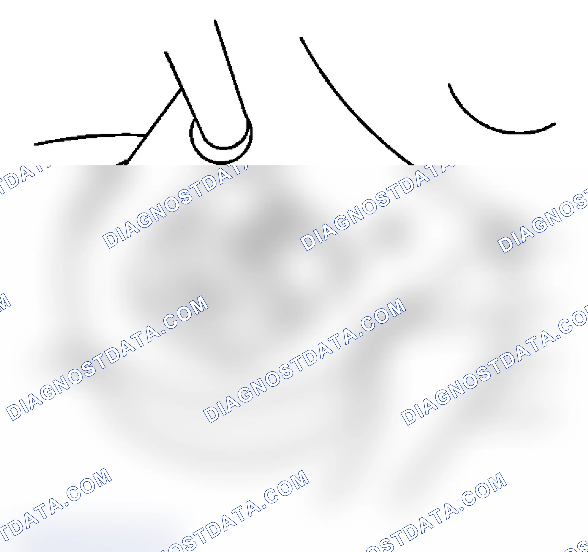 Scheme 8: Removal Procedure